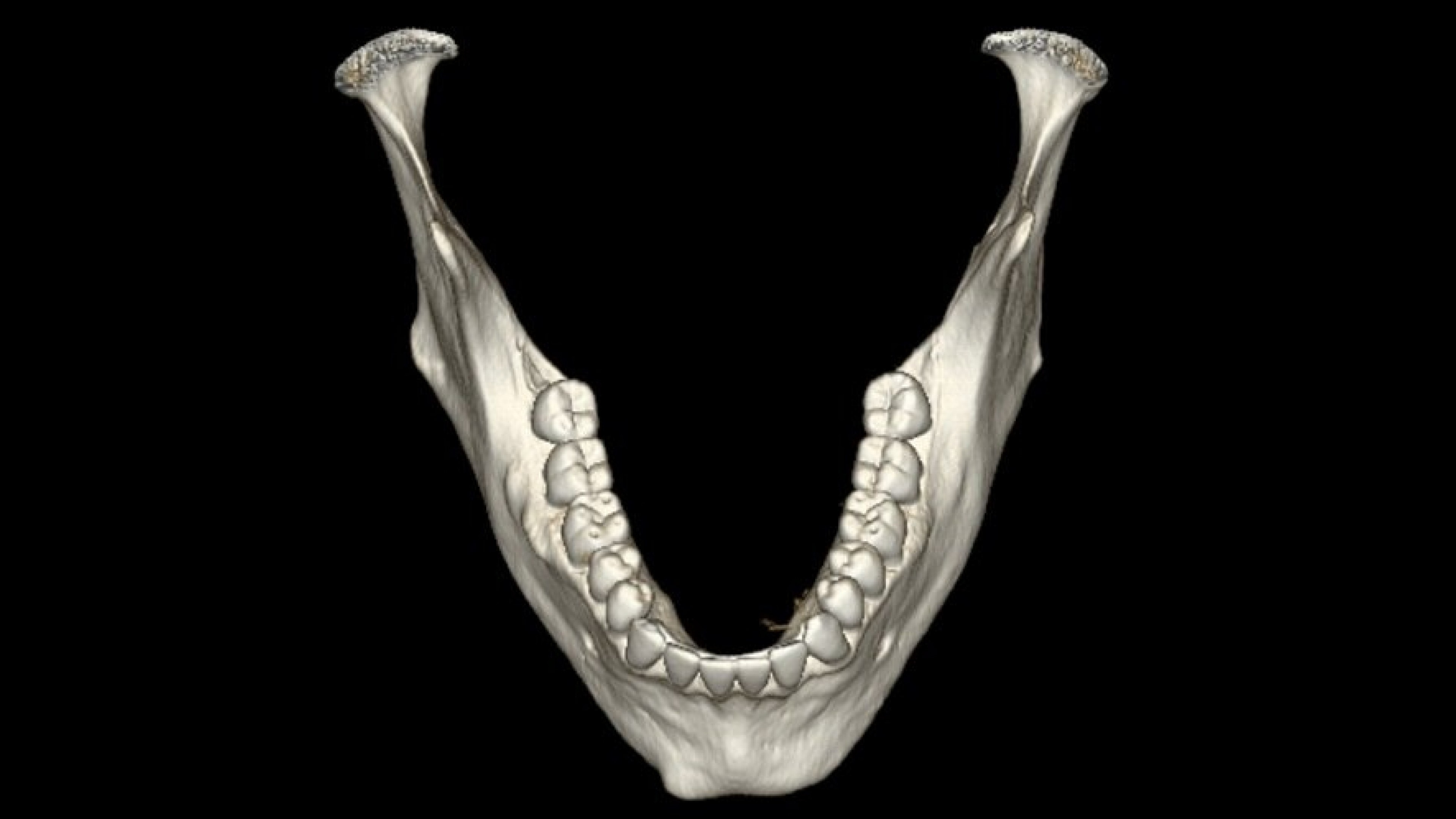 Product Media Carousel Image