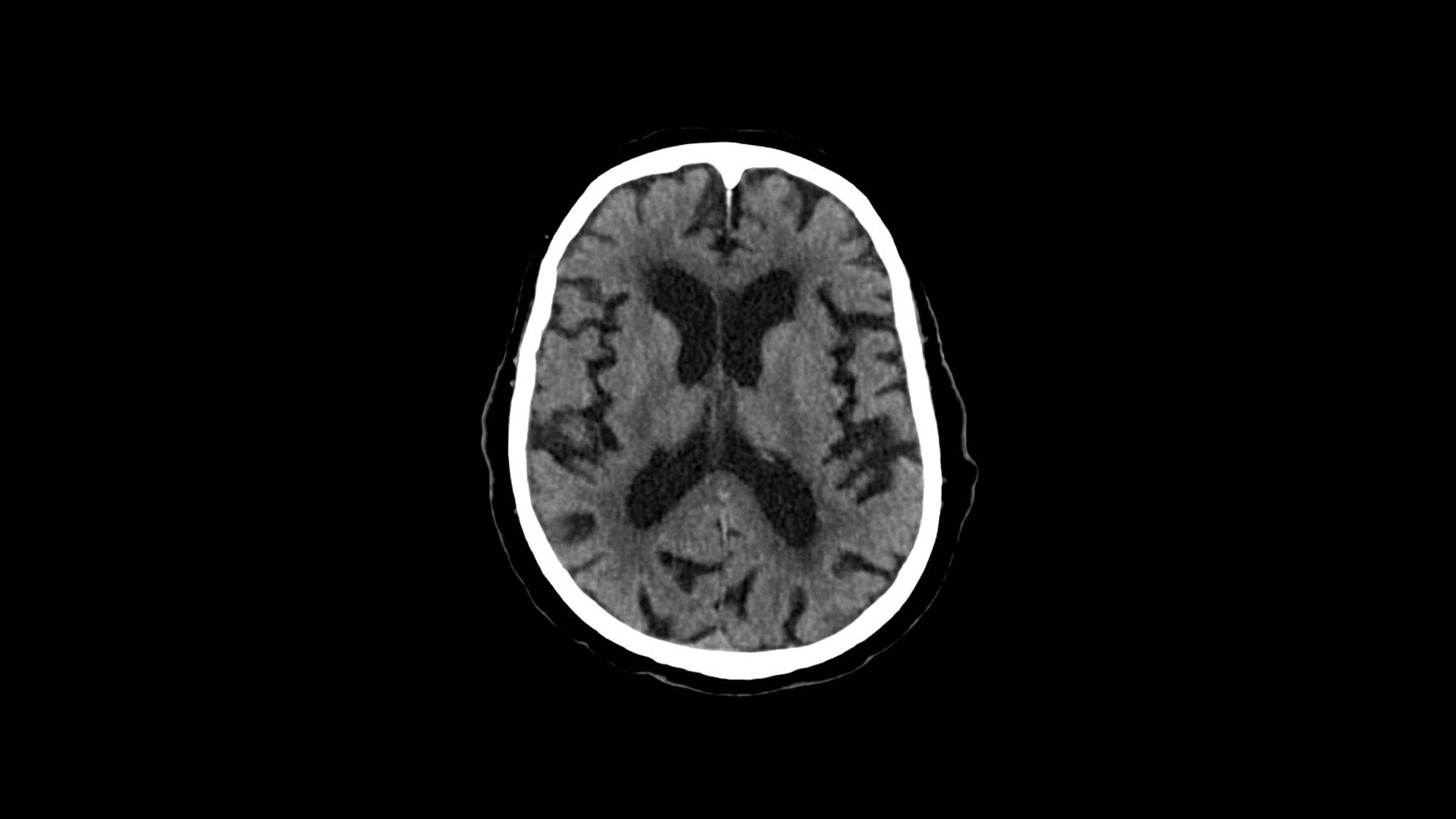 Product Media Carousel Image