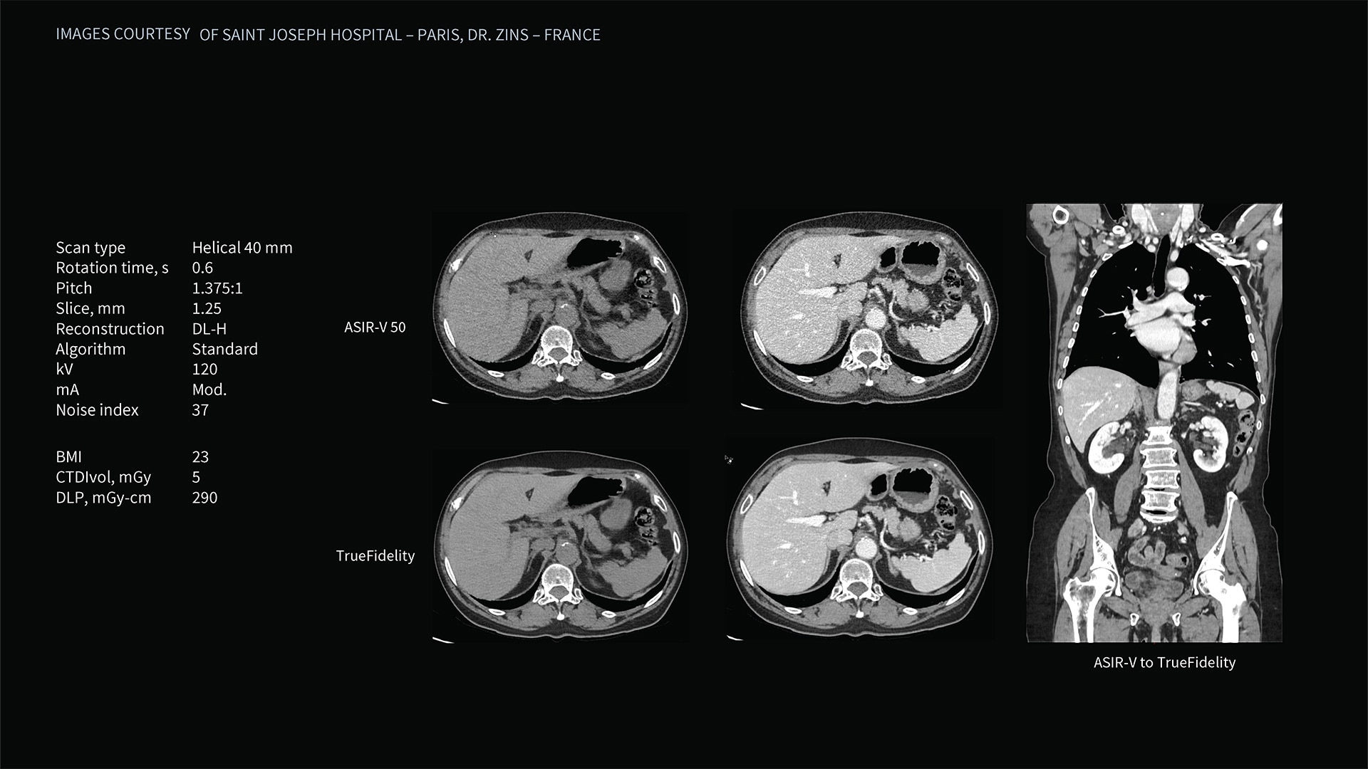 Product Media Carousel Image