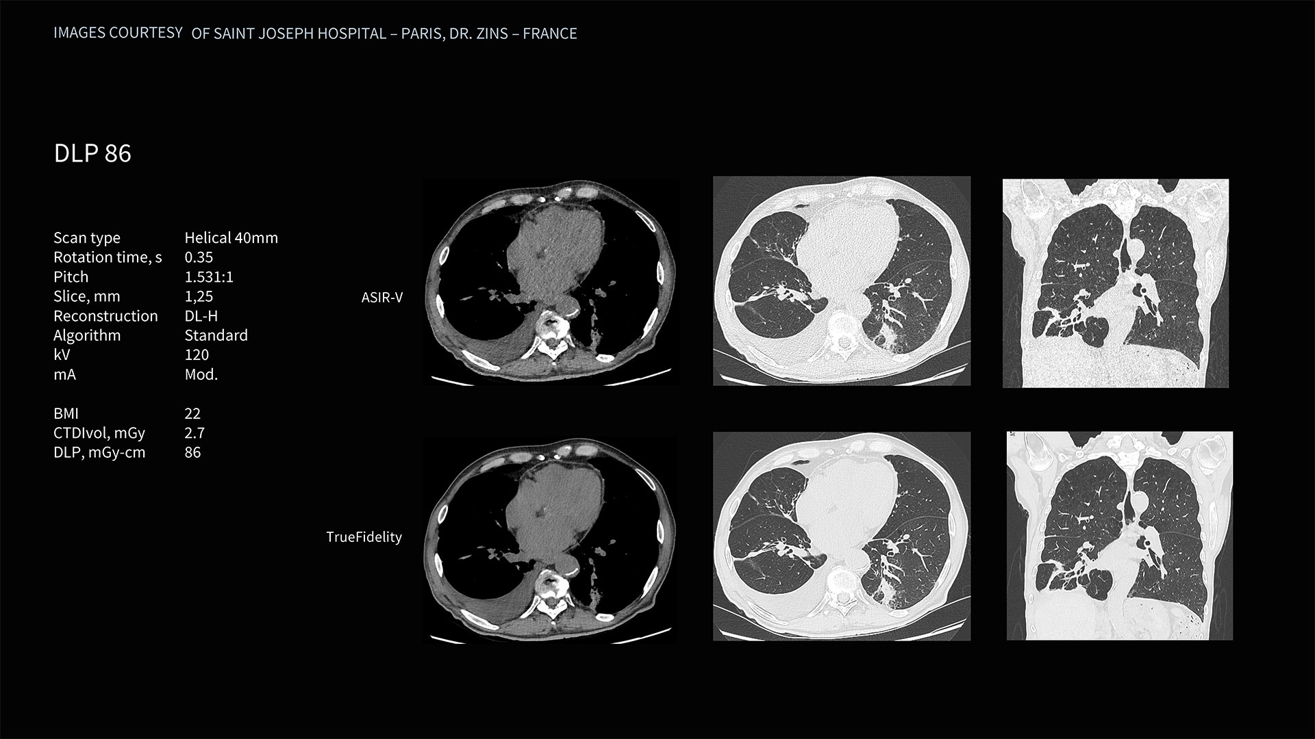 Product Media Carousel Image