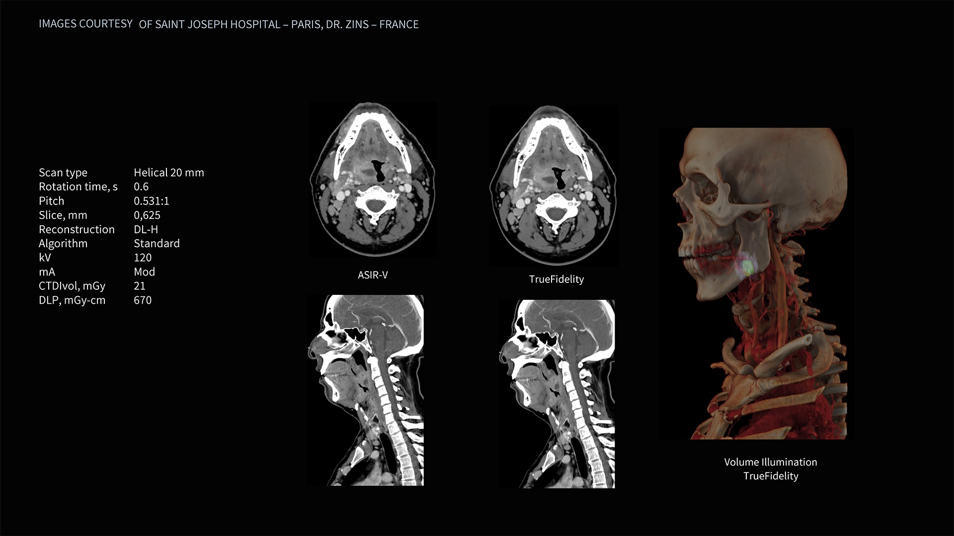 Product Media Carousel Image