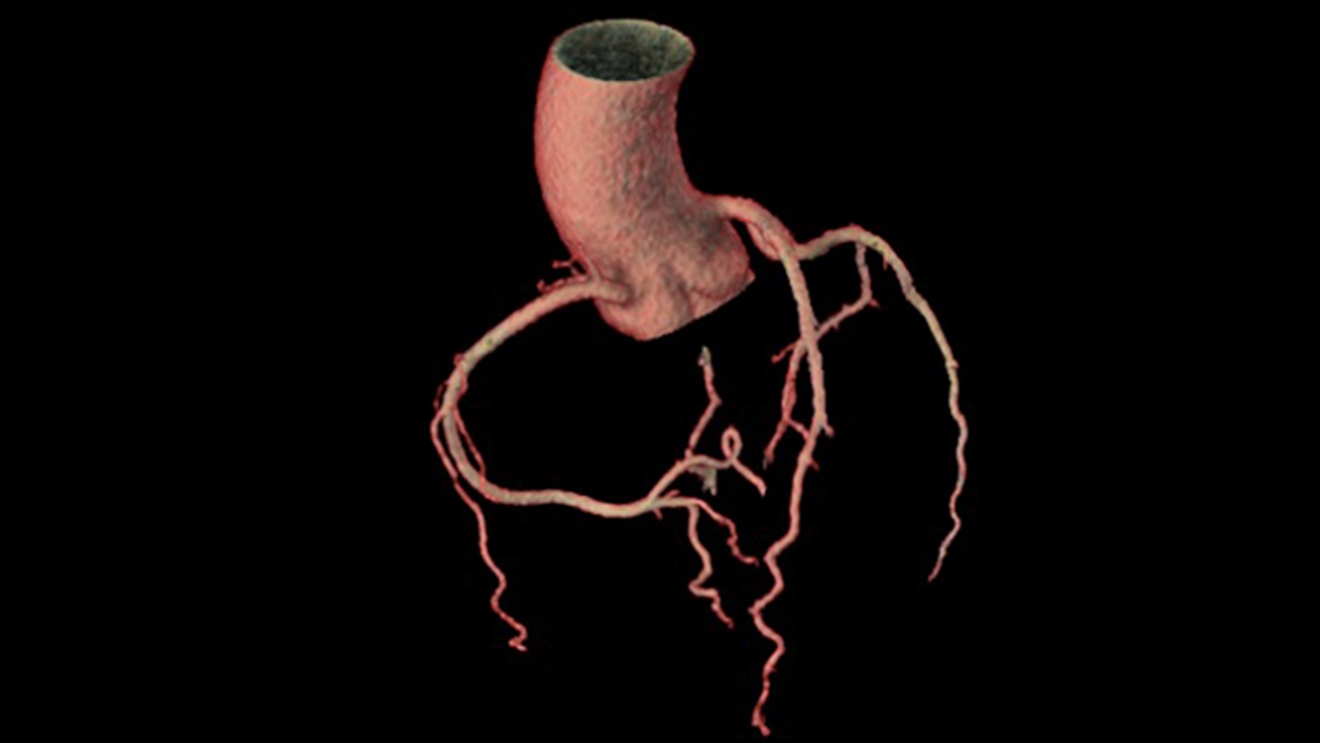 Product Media Carousel Image