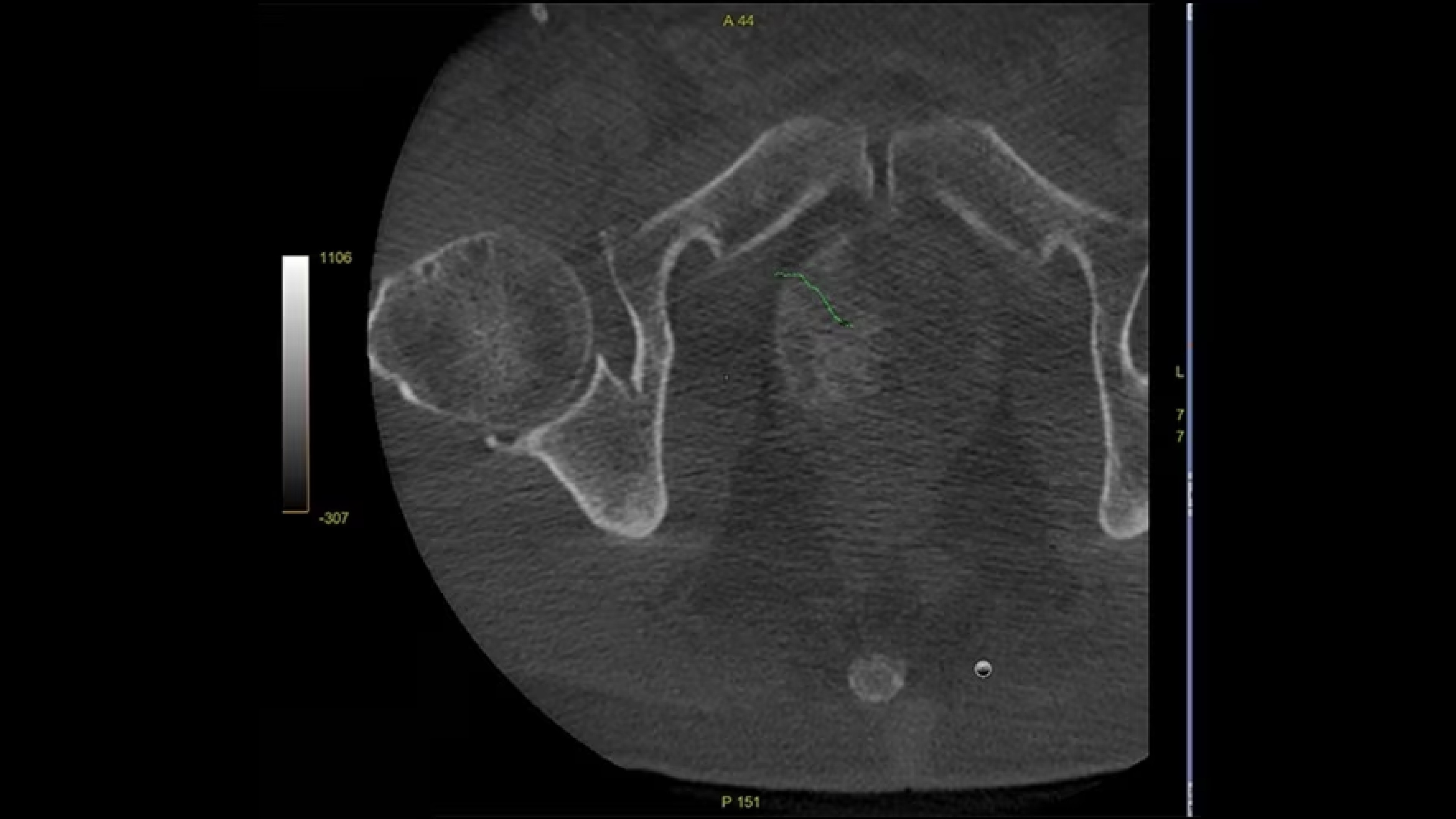 Product Media Carousel Image