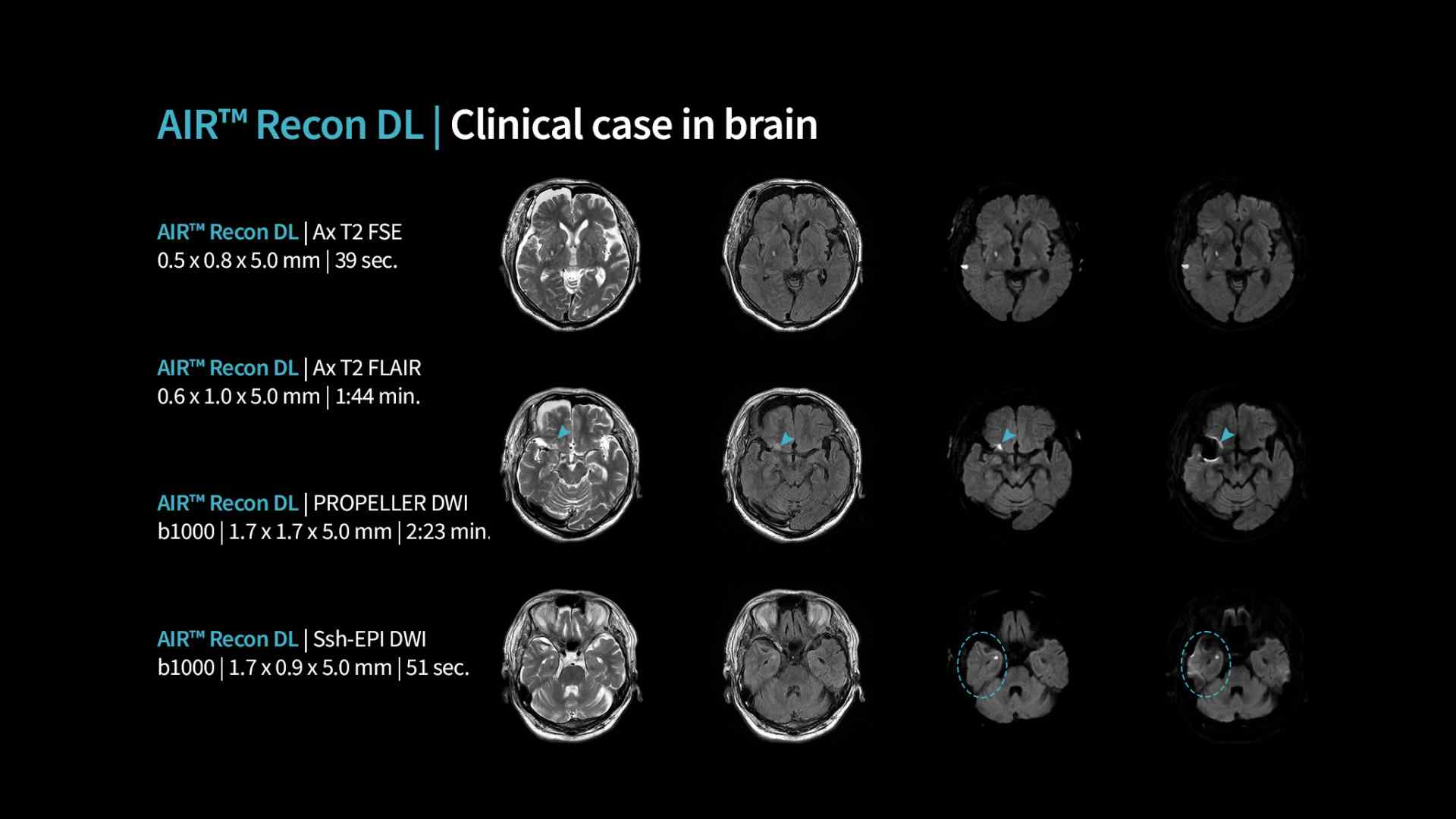 Product Media Carousel Image
