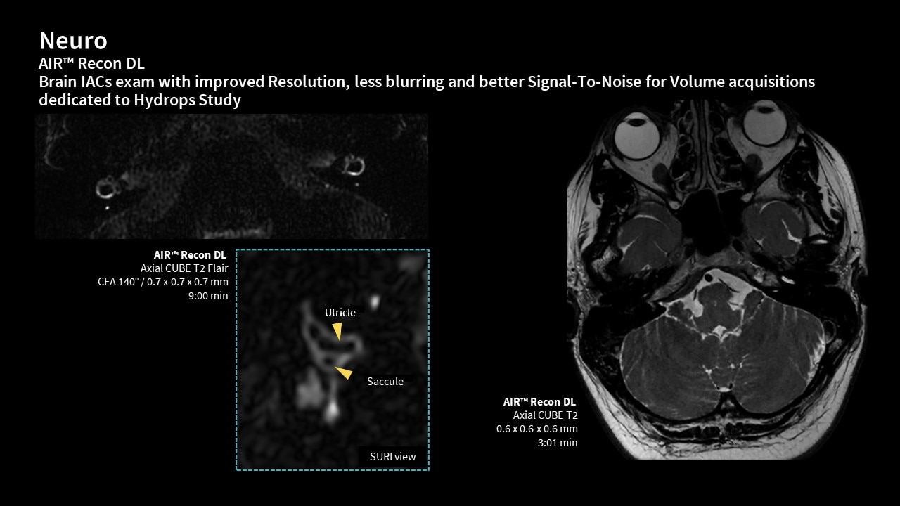 Product Media Carousel Image
