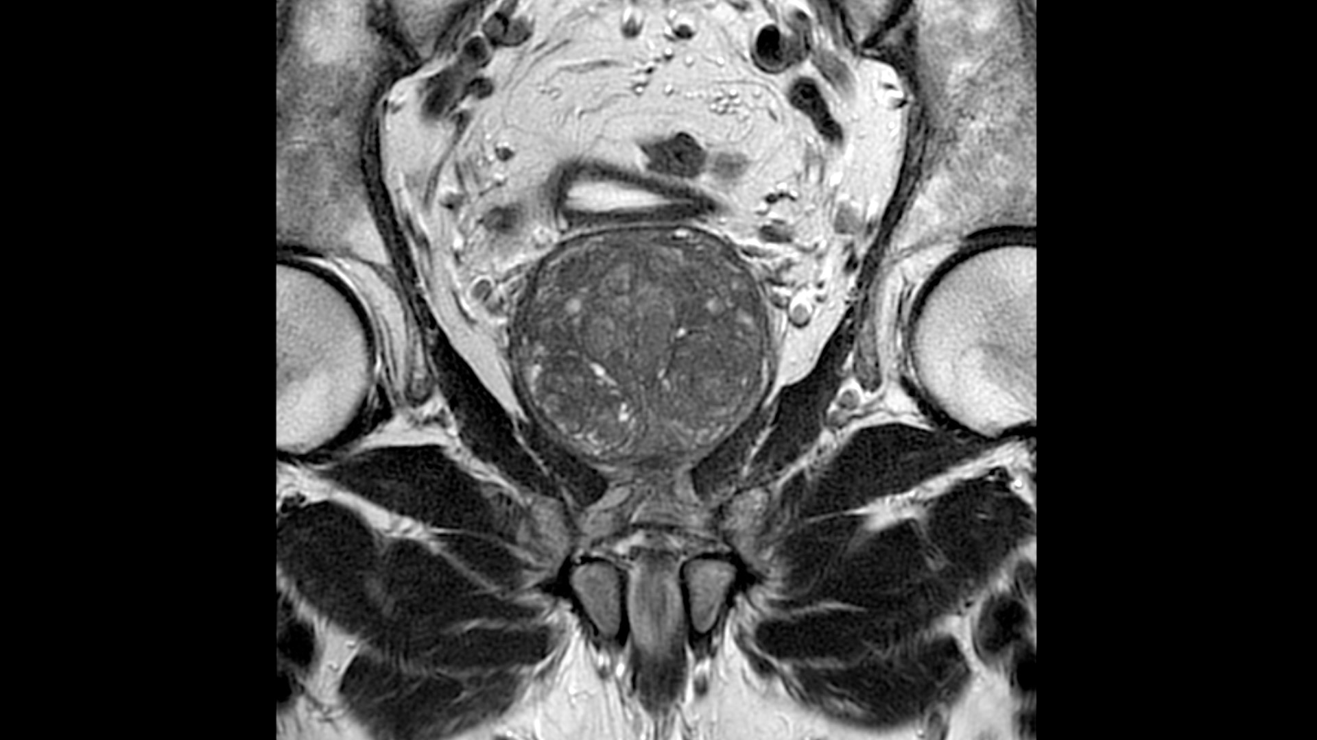 Product Media Carousel Image