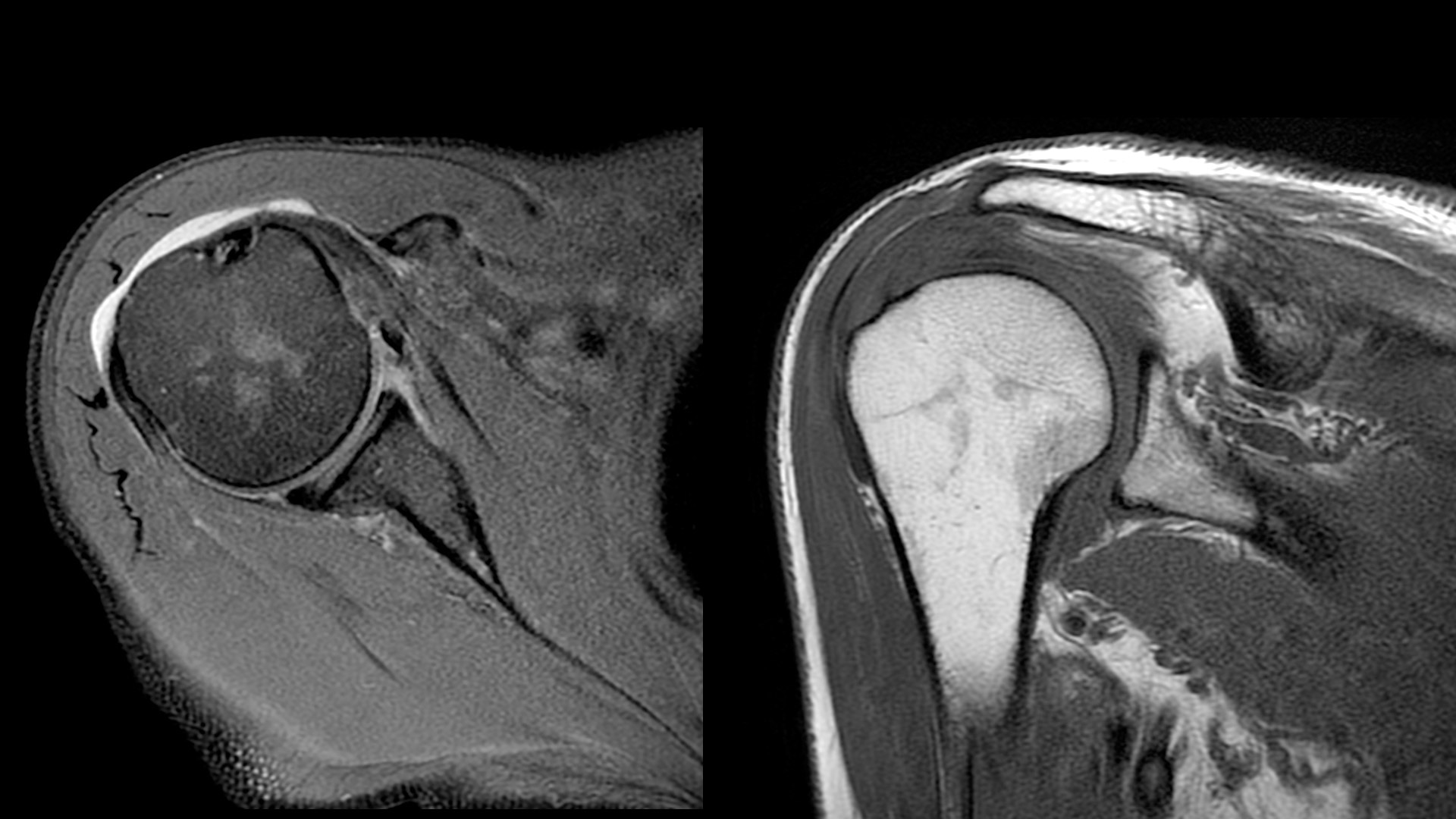 Product Media Carousel Image
