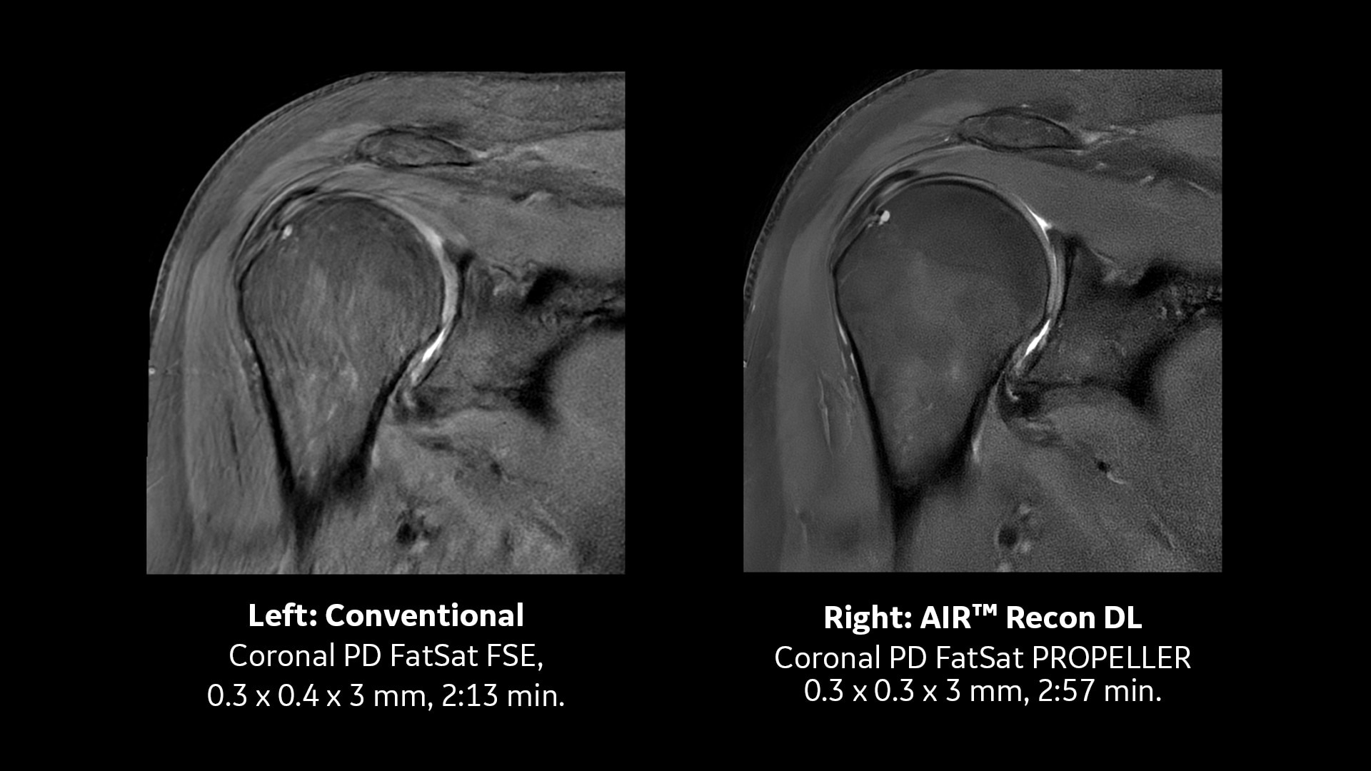 Product Media Carousel Image