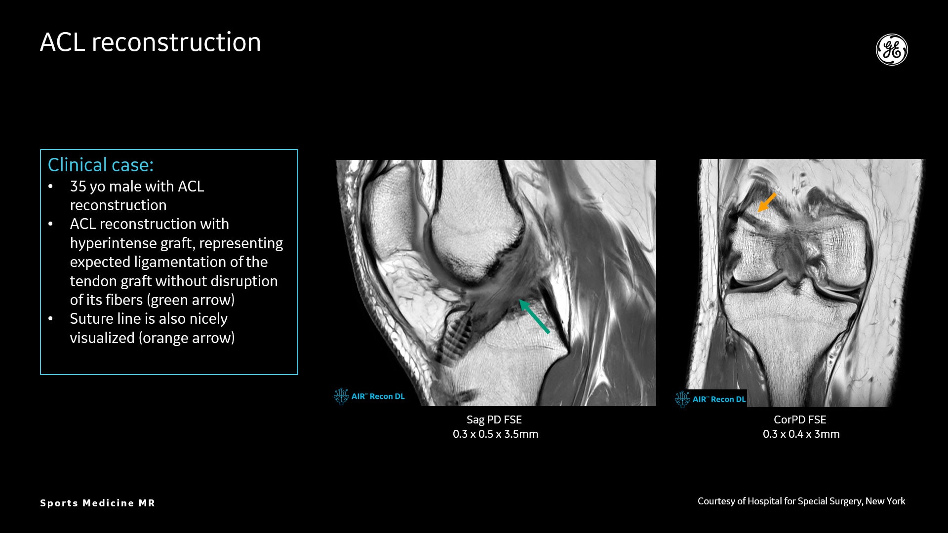 Product Media Carousel Image