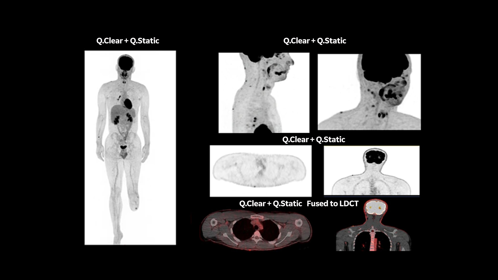 Product Media Carousel Image