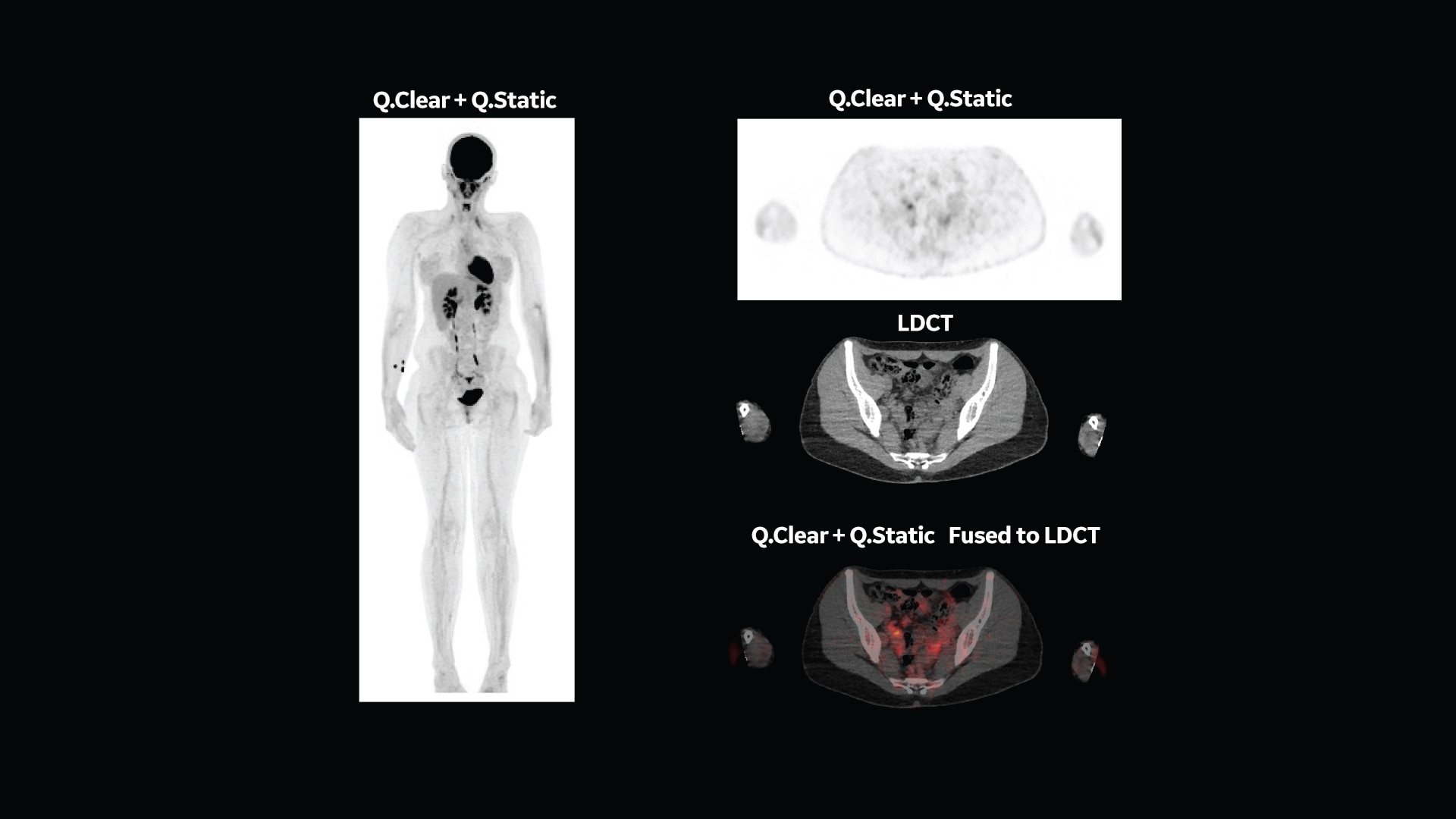 Product Media Carousel Image