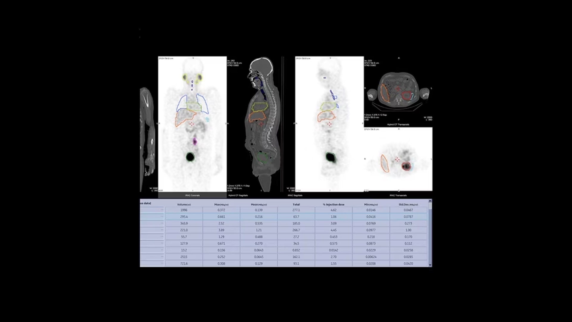 Product Media Carousel Image