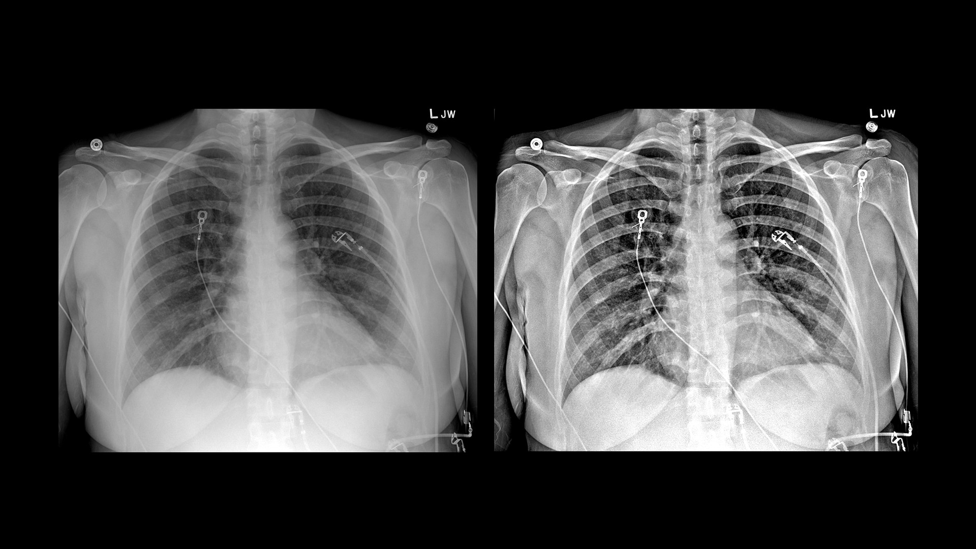 Product Media Carousel Image