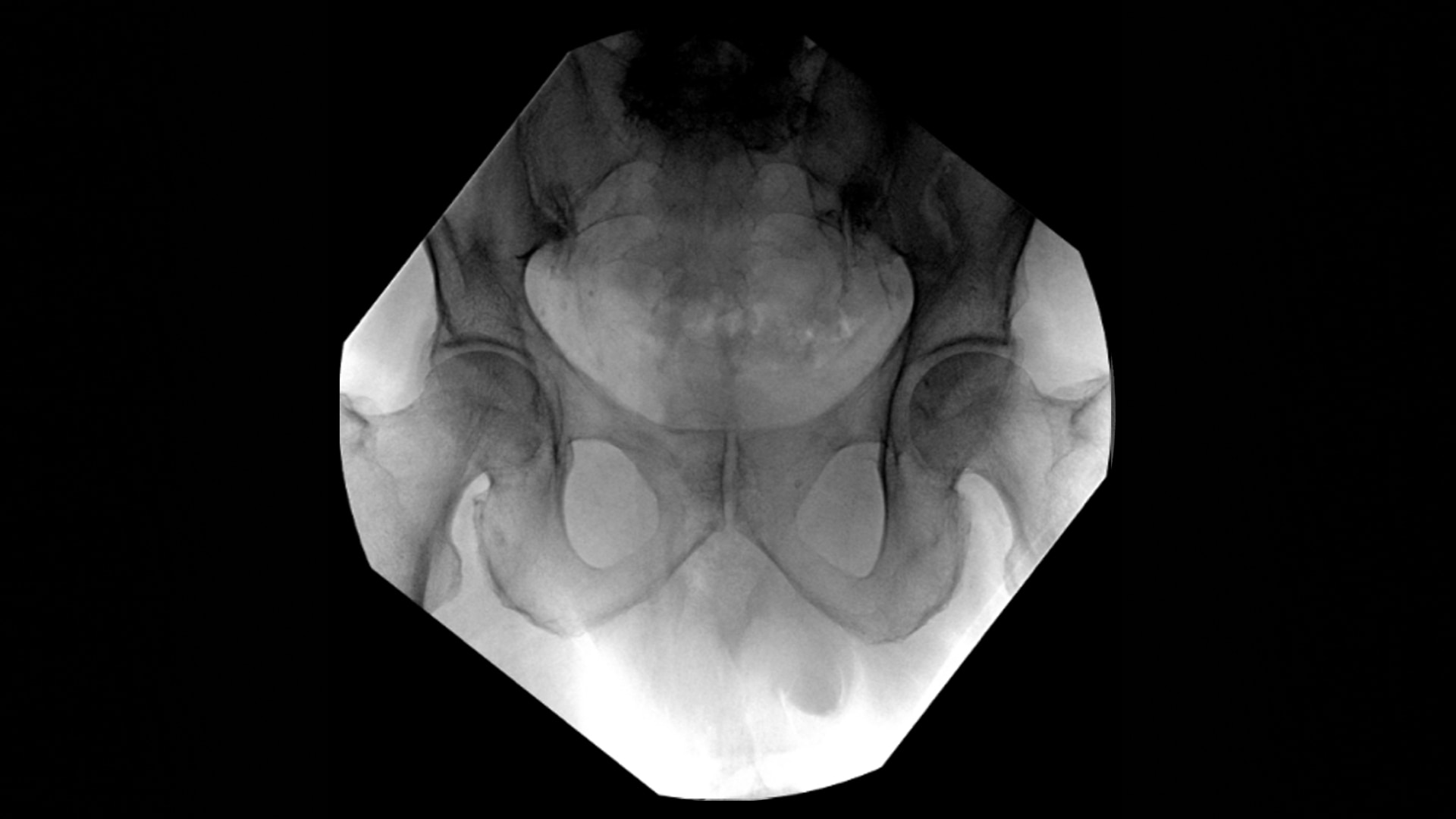 Product Media Carousel Image