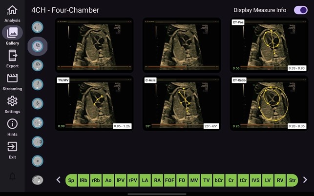 Product Media Carousel Image