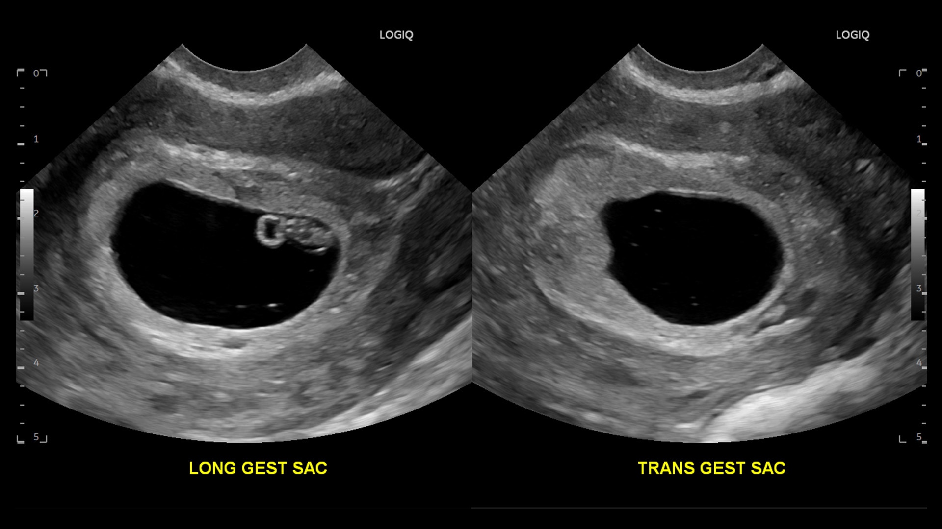 Product Media Carousel Image