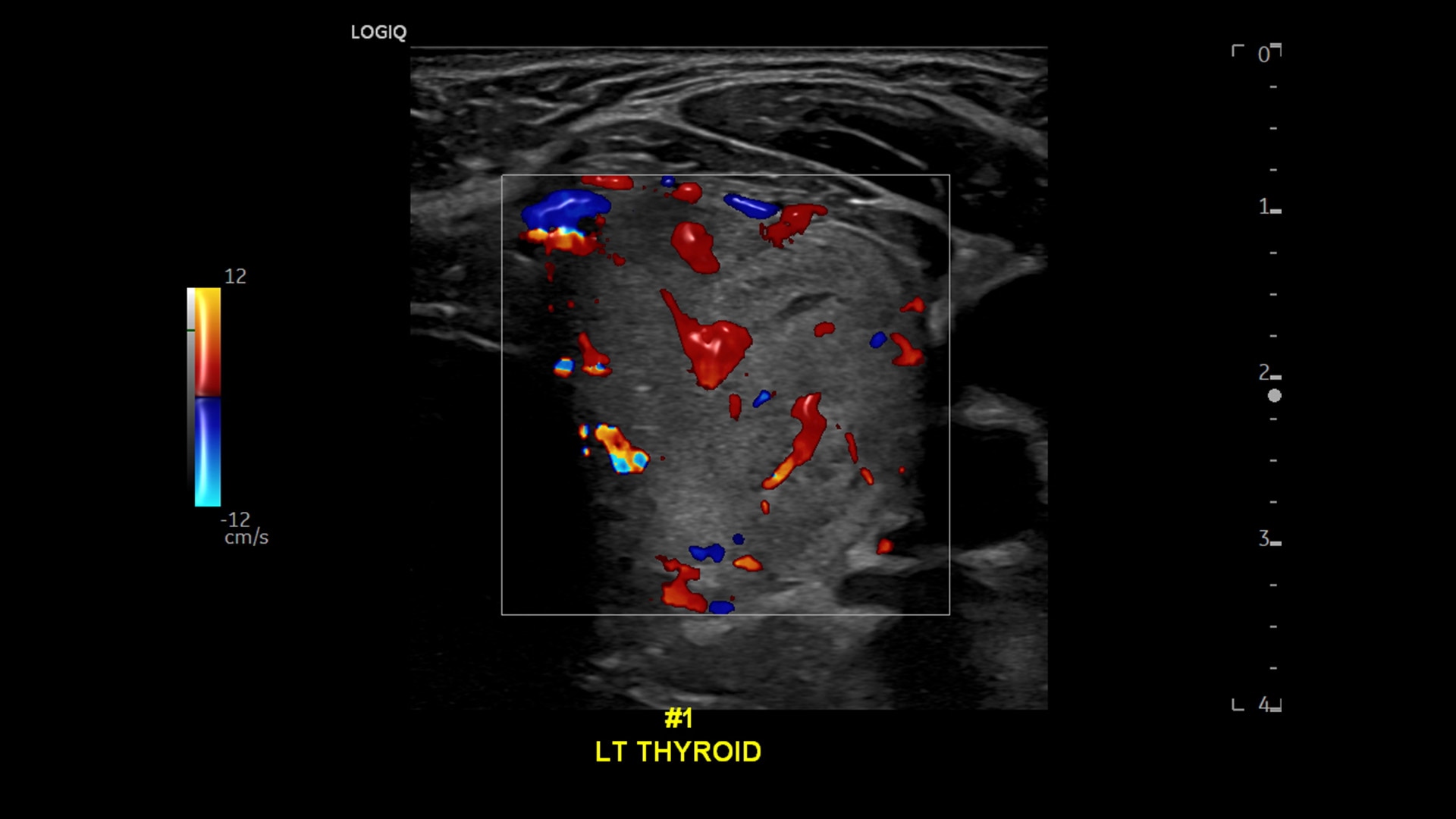 Product Media Carousel Image