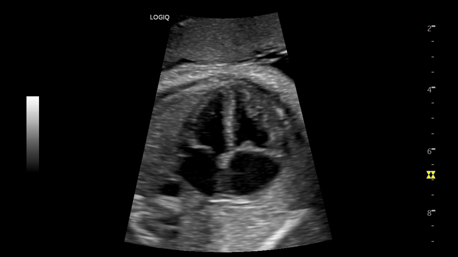 Product Media Carousel Image