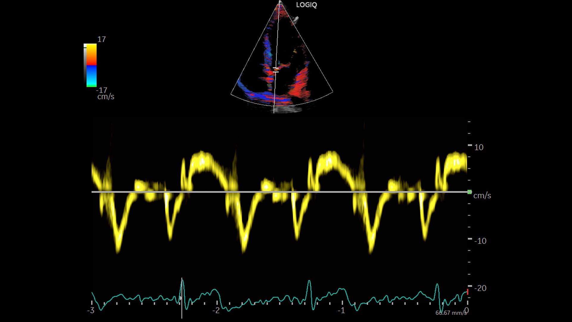 Product Media Carousel Image