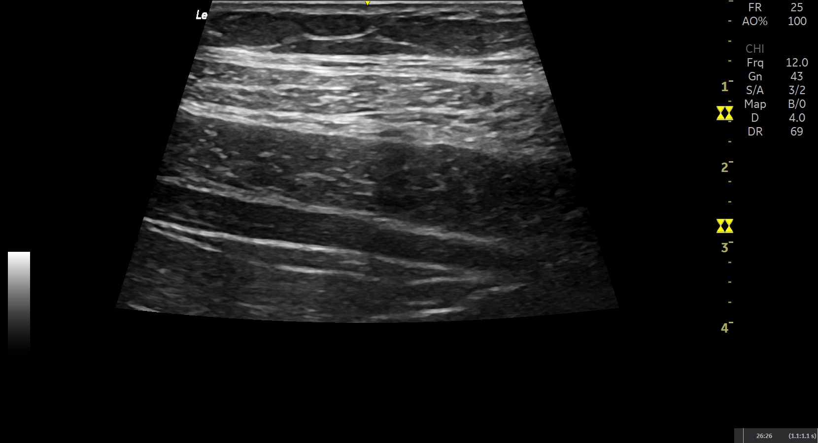 Product Media Carousel Image