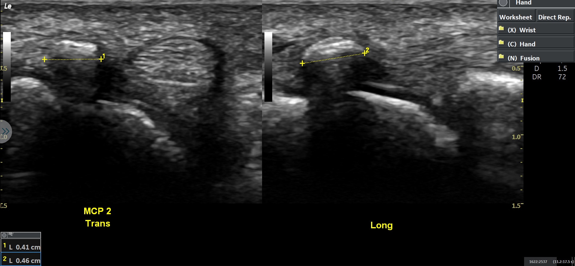 Product Media Carousel Image