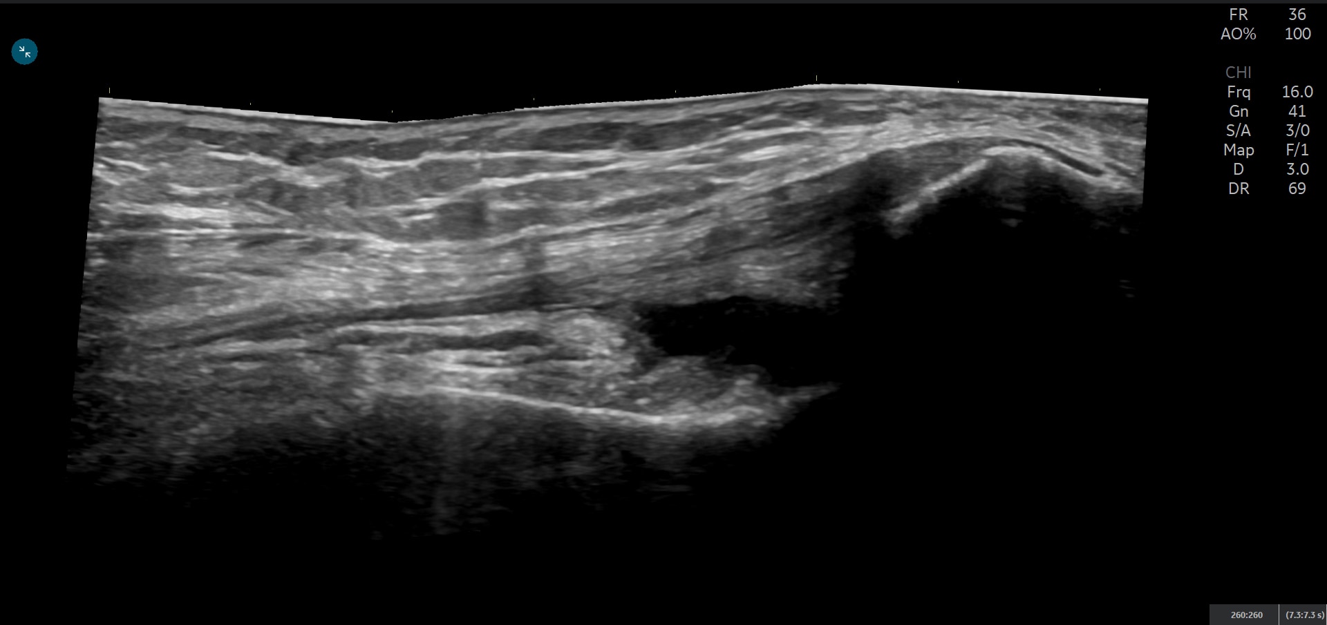 Product Media Carousel Image