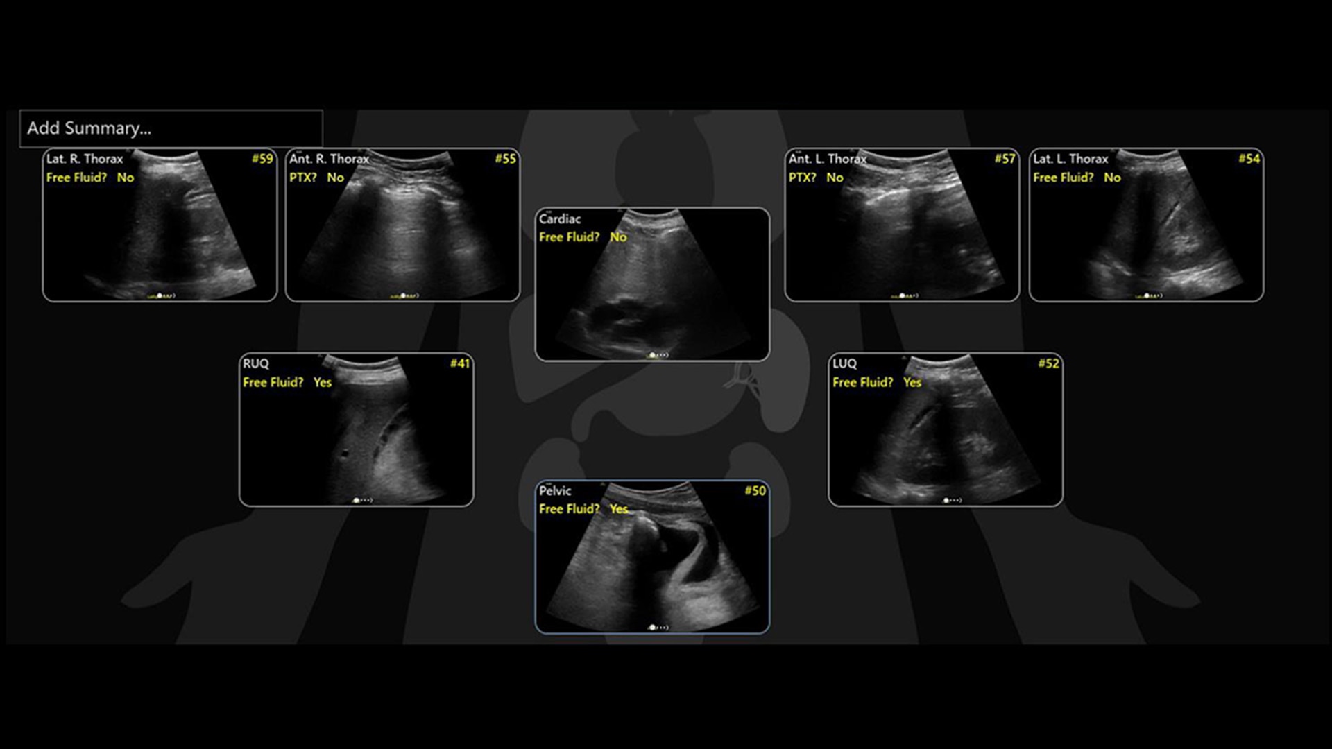 Product Media Carousel Image