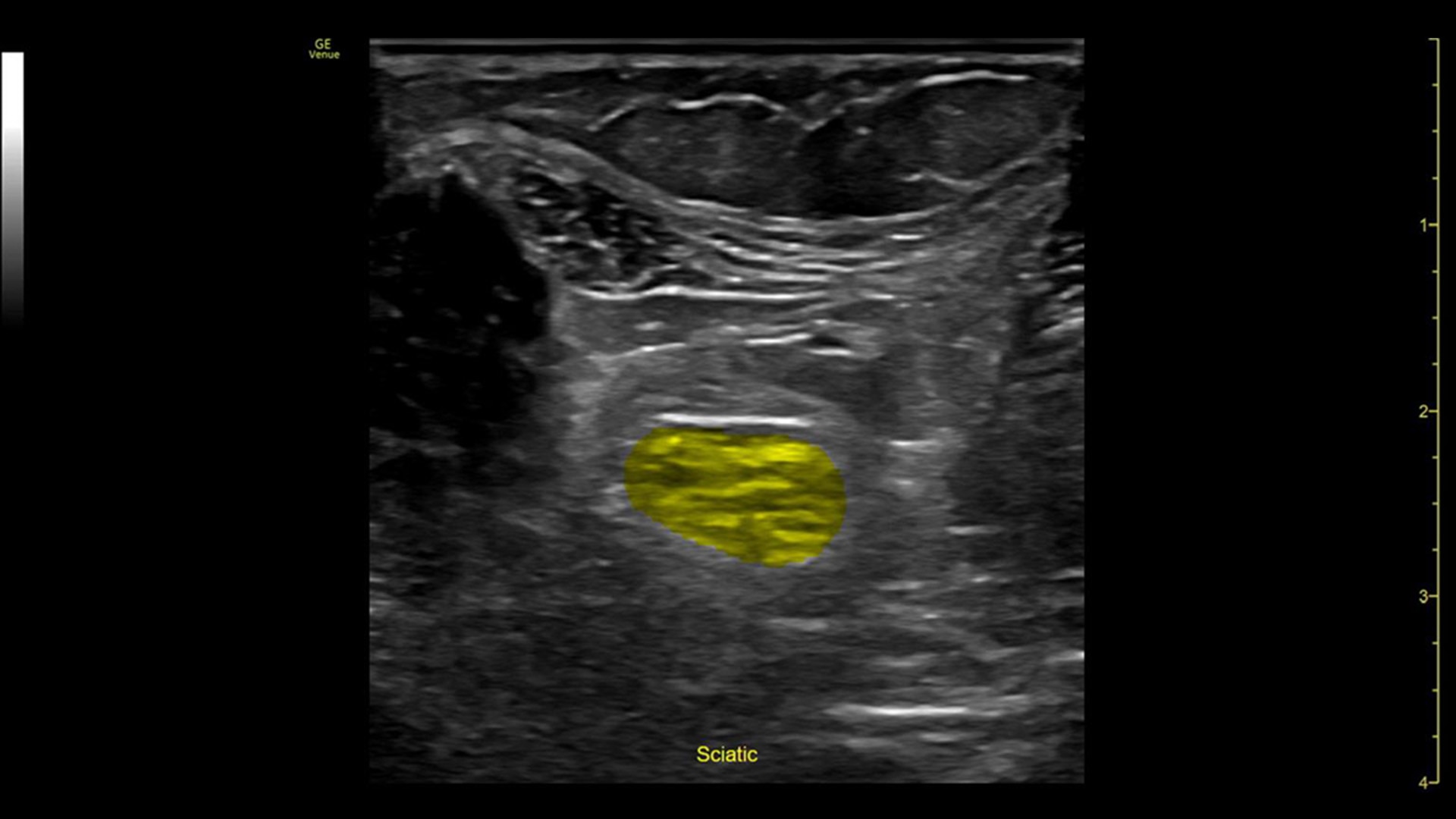 Product Media Carousel Image