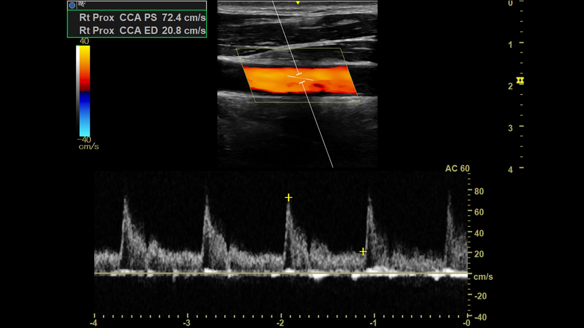 Product Media Carousel Image