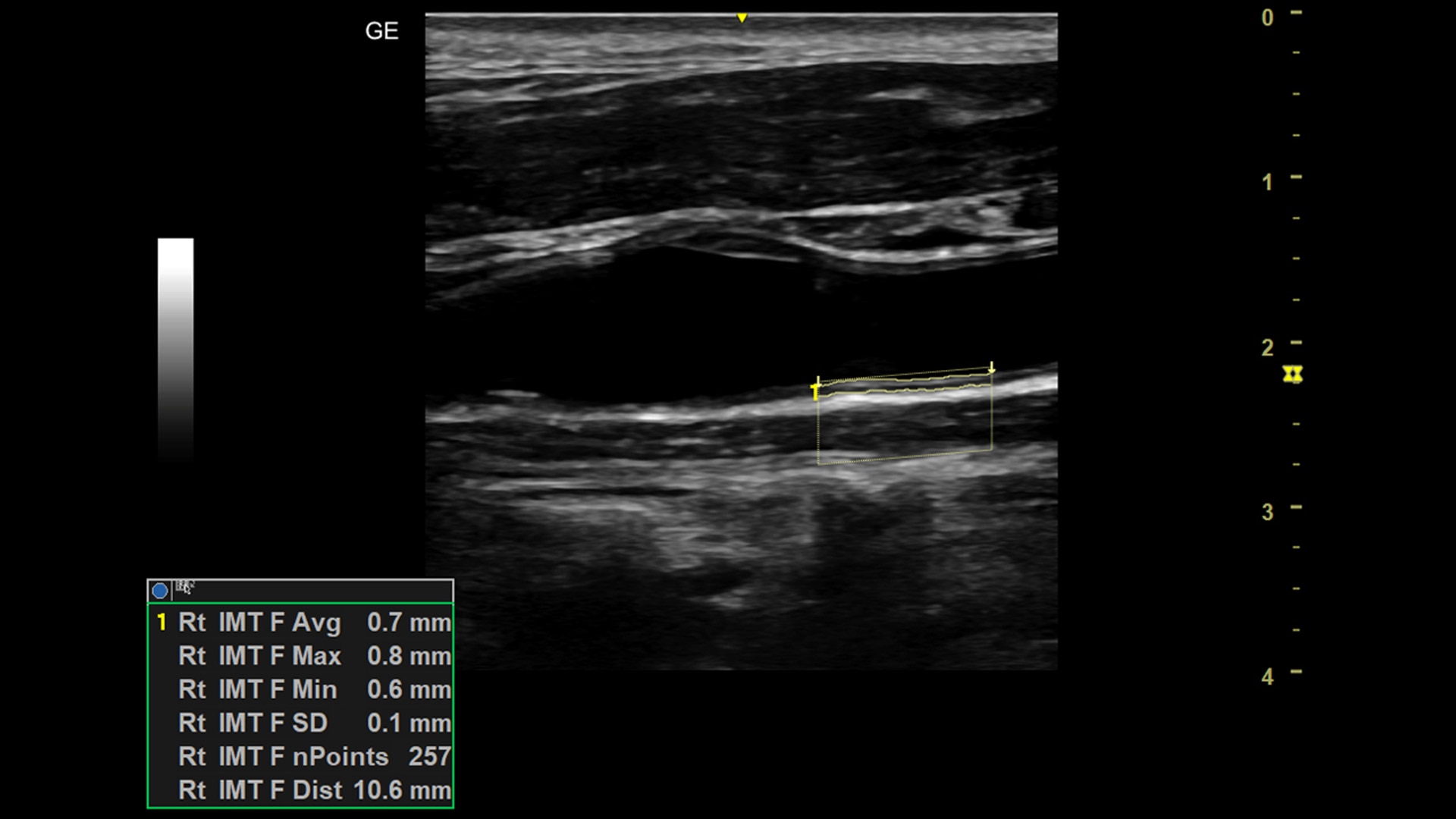 Product Media Carousel Image