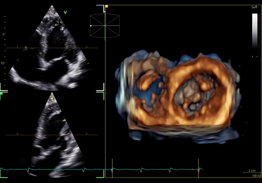 Product Media Carousel Image