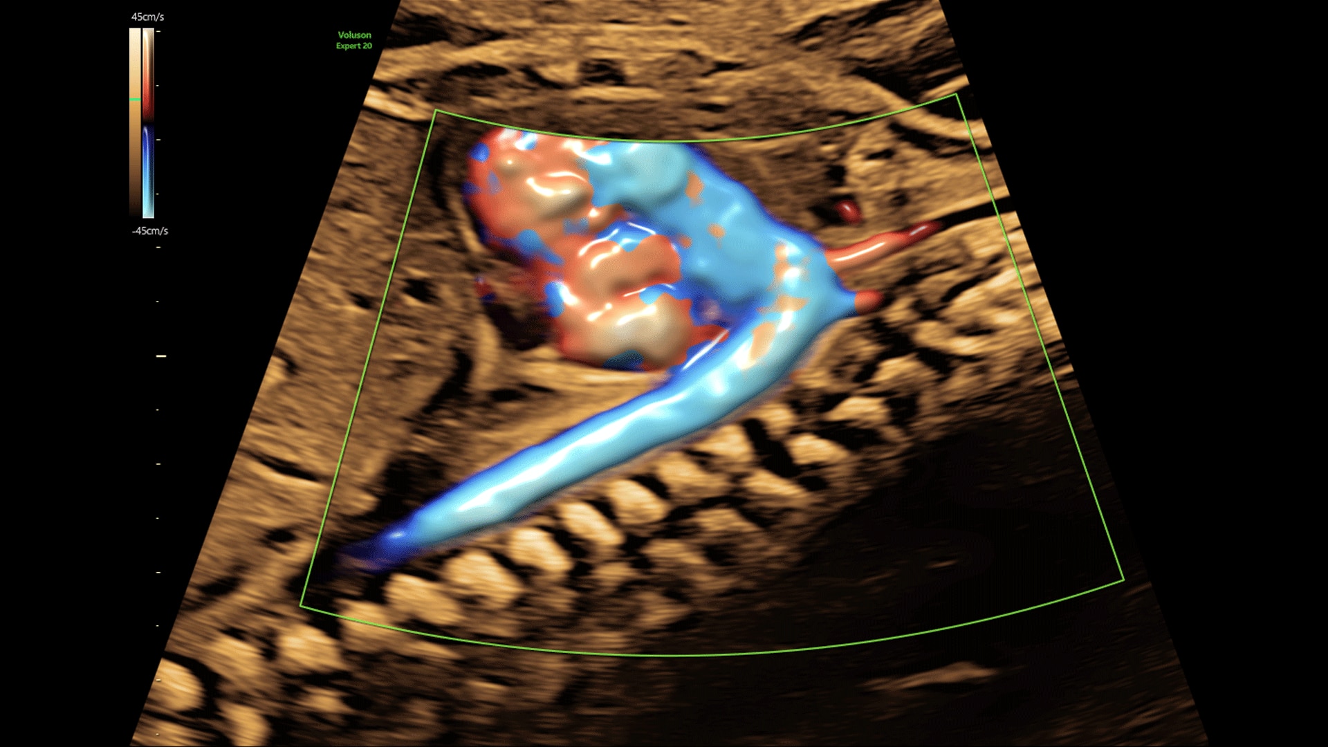 Product Media Carousel Image