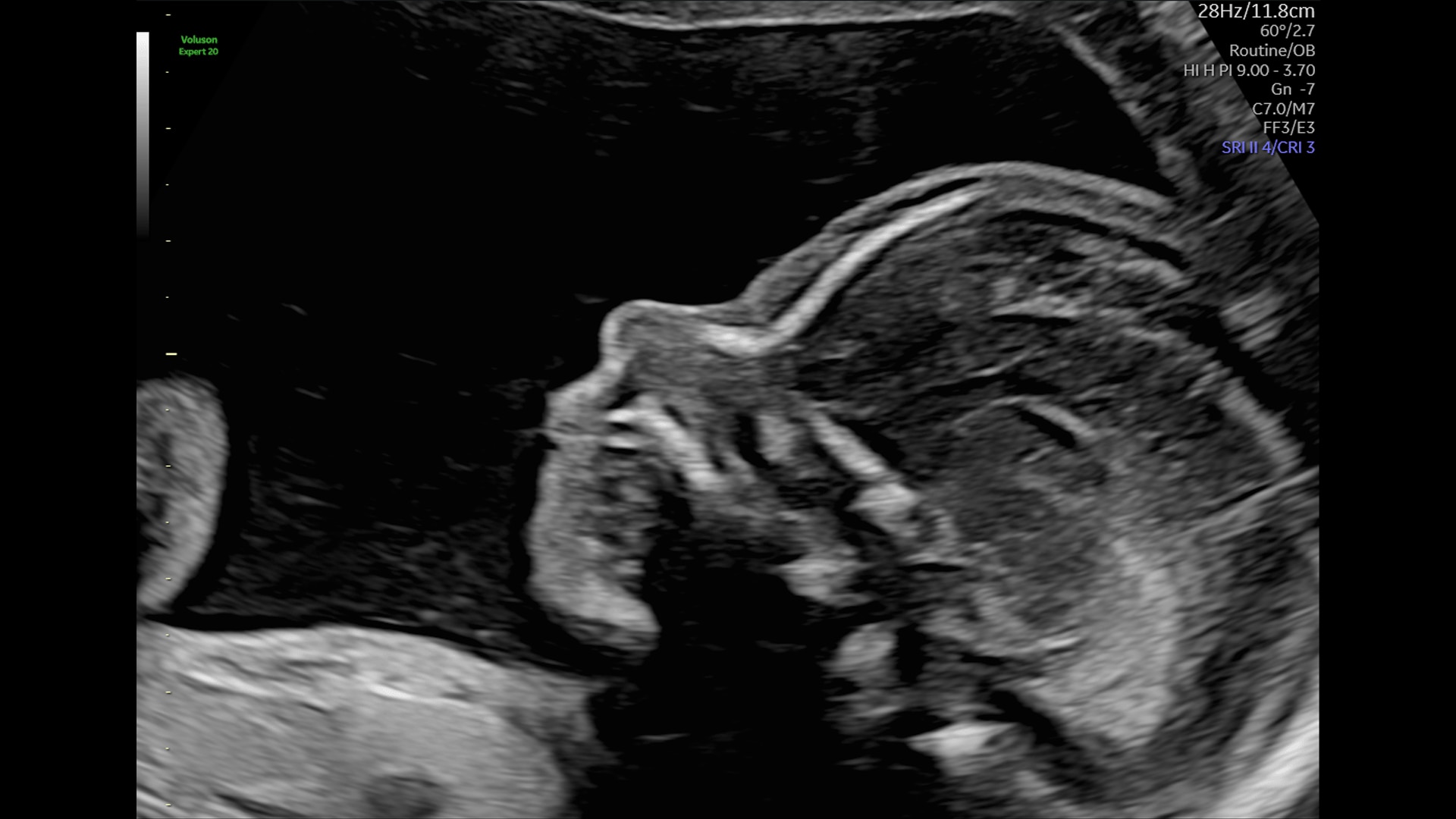 Product Media Carousel Image