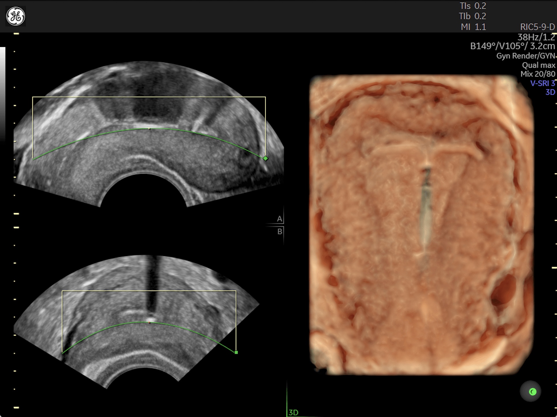 Product Media Carousel Image