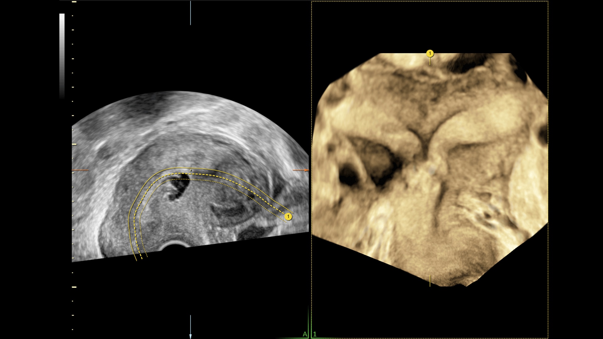 Product Media Carousel Image