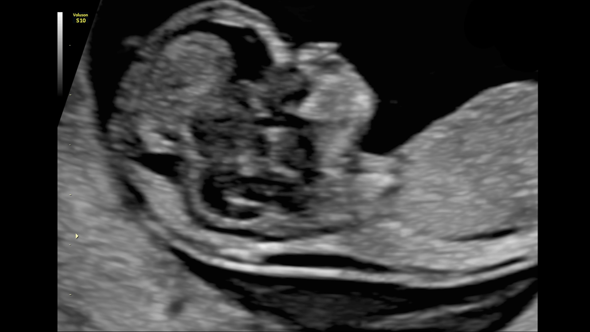 Product Media Carousel Image