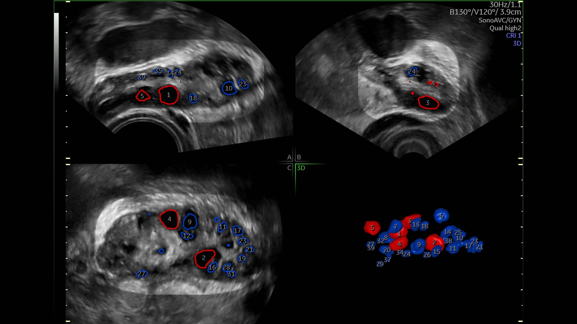 Product Media Carousel Image