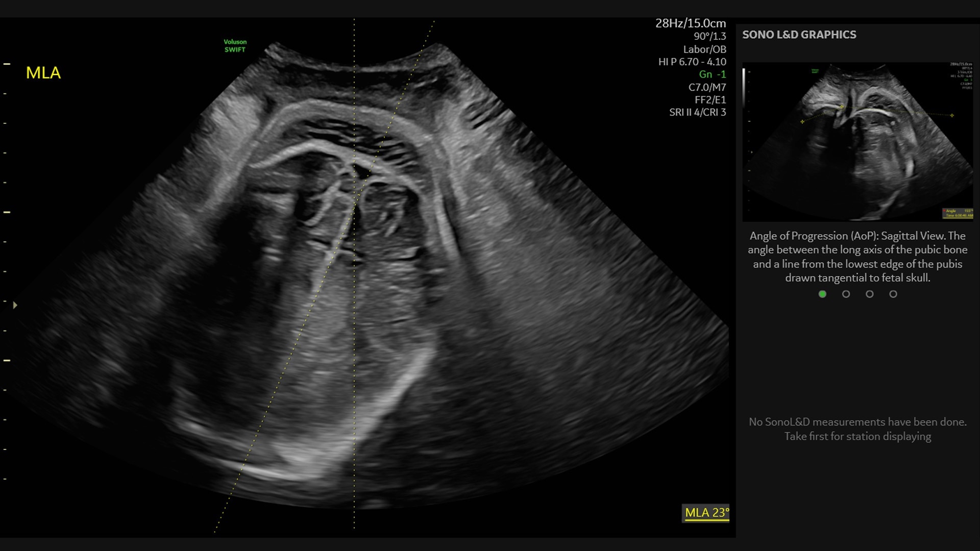 Product Media Carousel Image