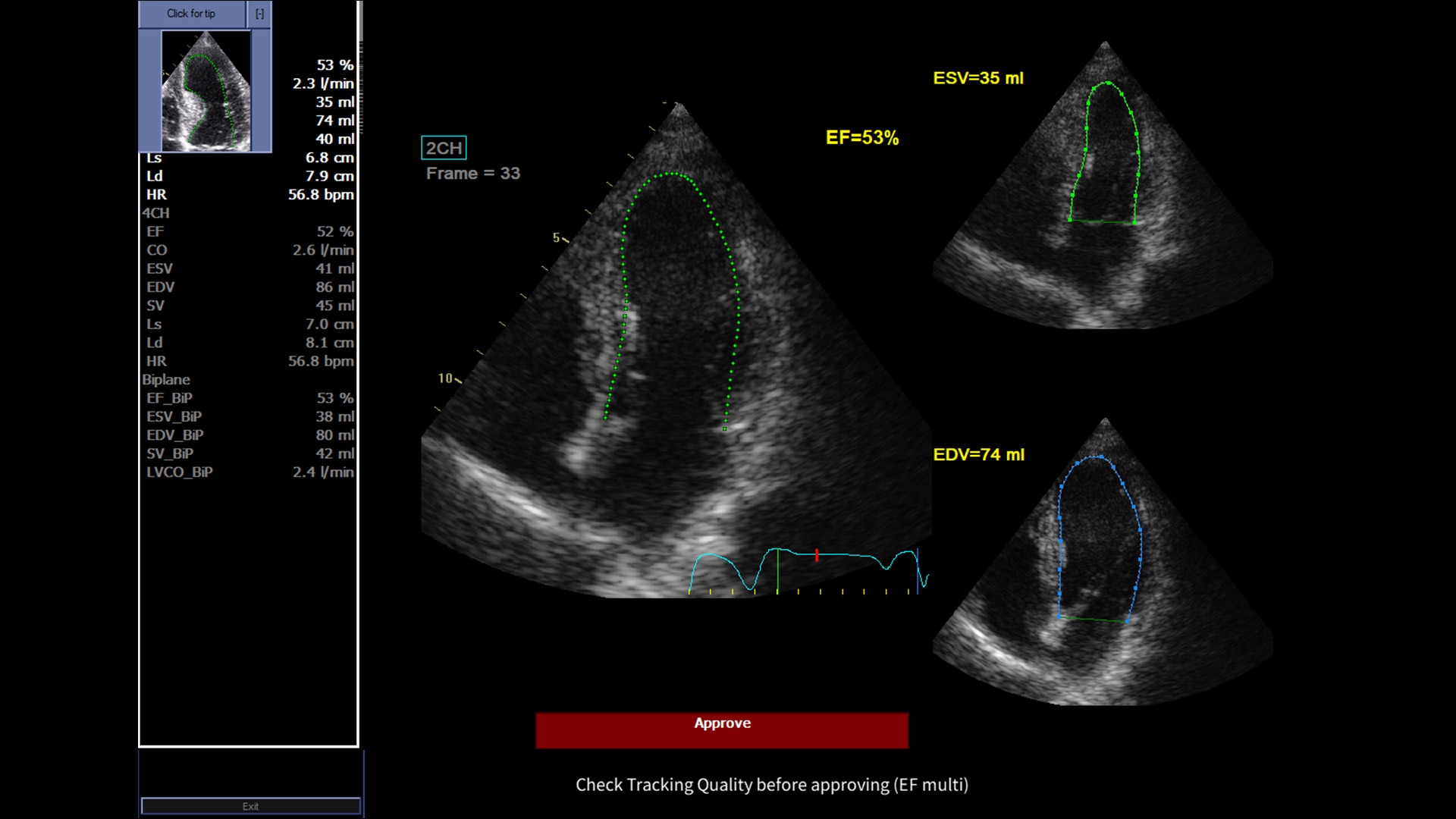 Product Media Carousel Image