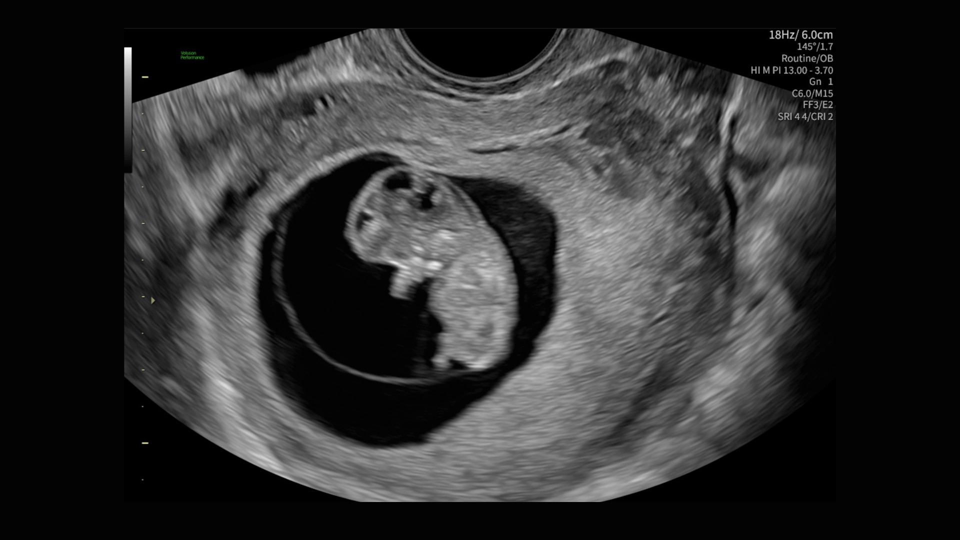 Product Media Carousel Image