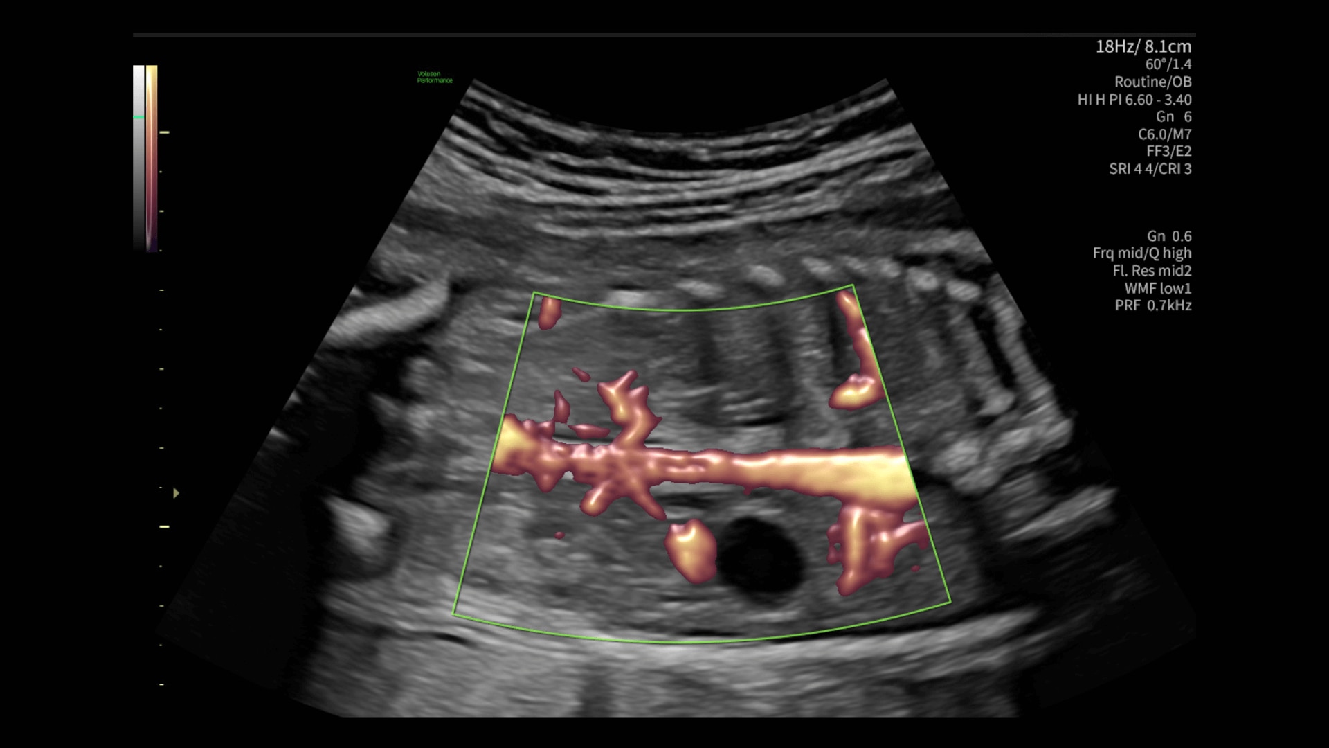 Product Media Carousel Image