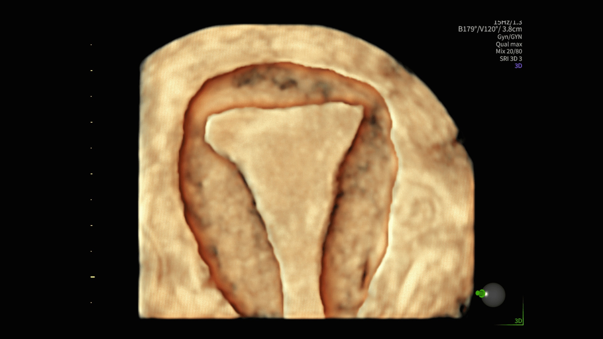 Product Media Carousel Image