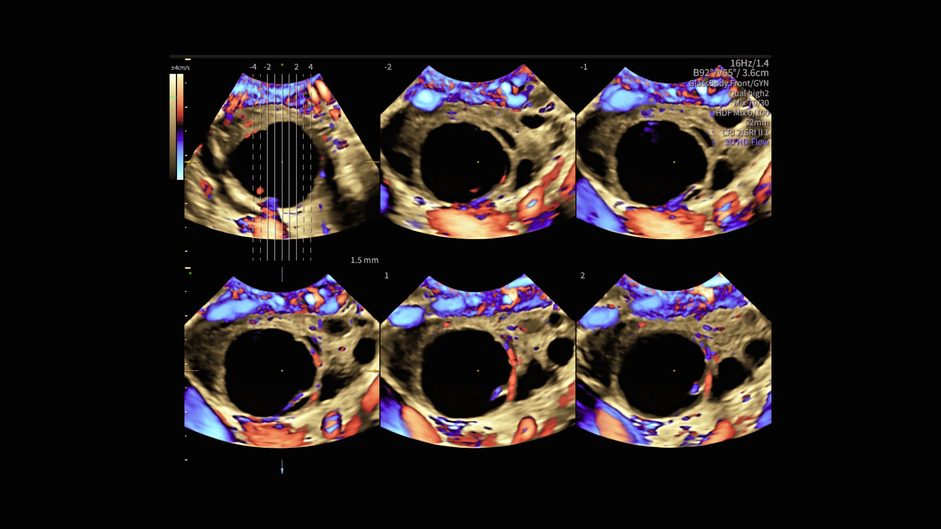 Product Media Carousel Image
