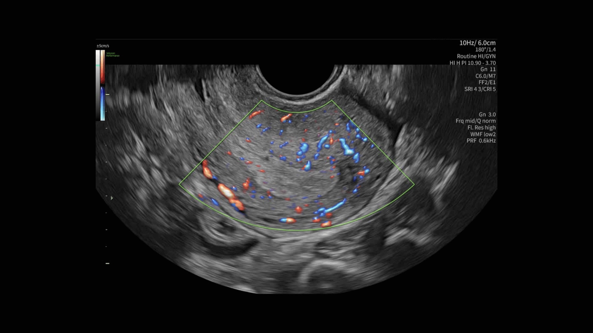 Product Media Carousel Image