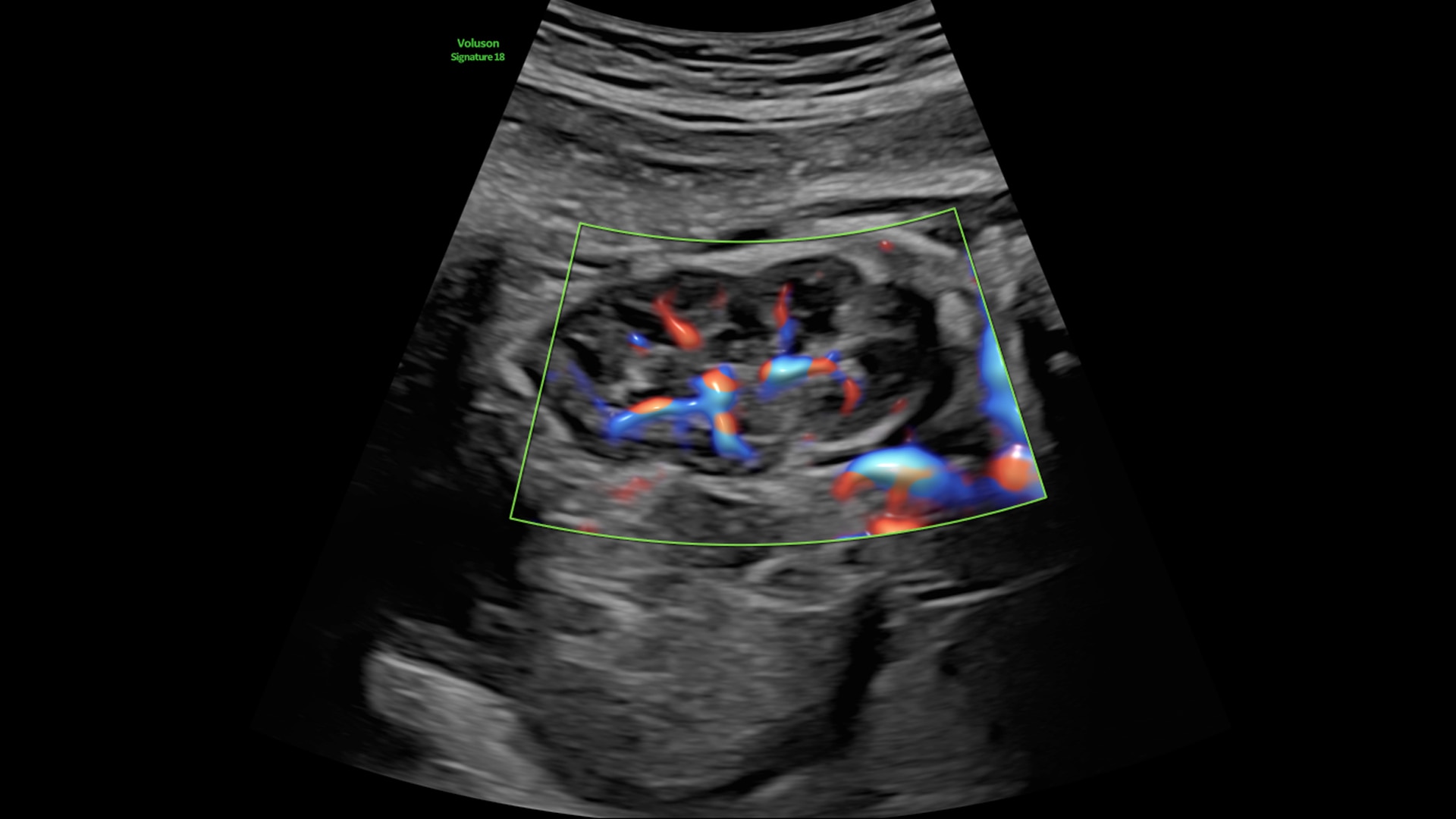 Product Media Carousel Image