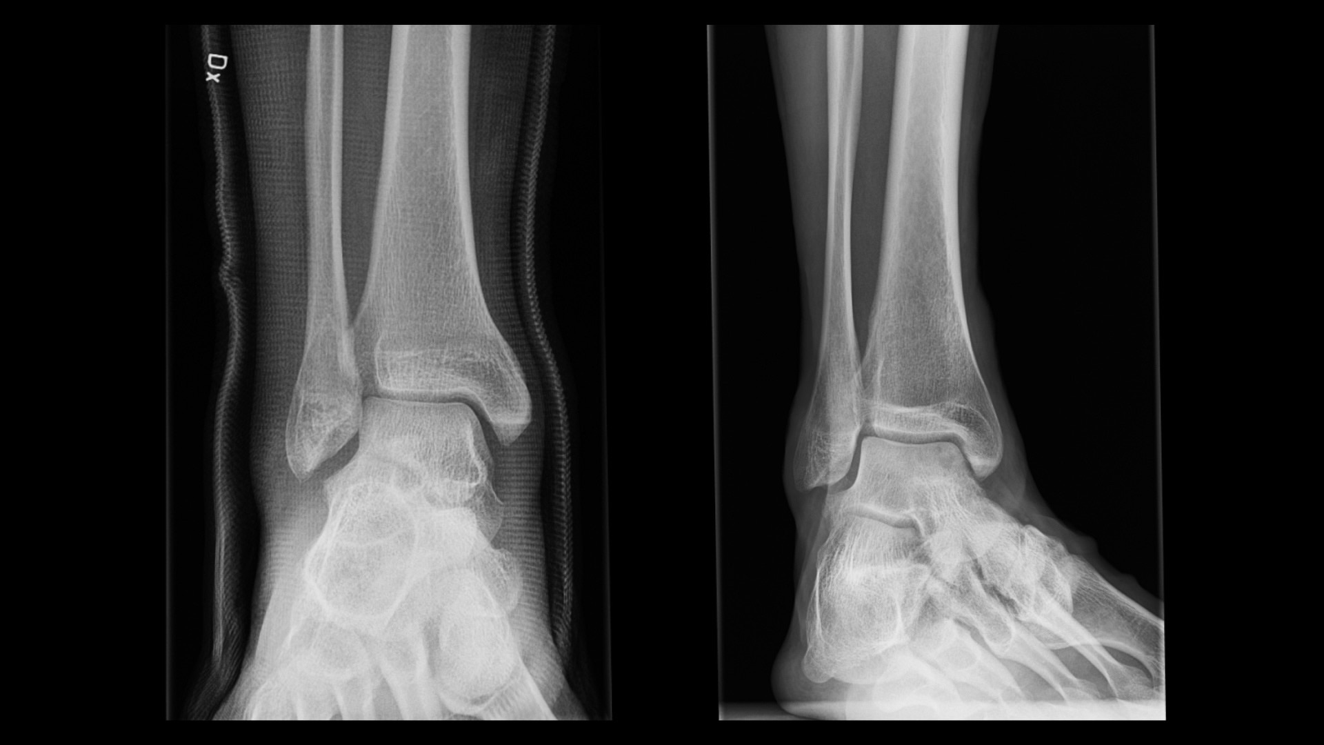 Product Media Carousel Image