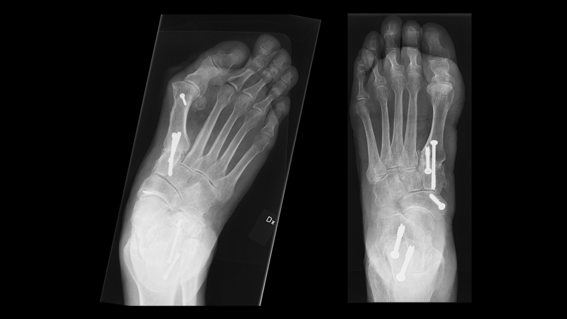 Product Media Carousel Image