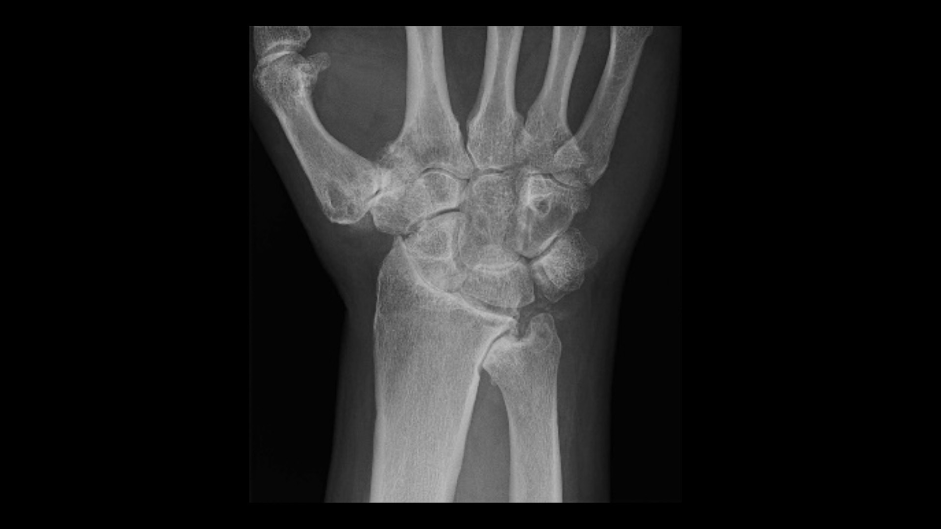 Product Media Carousel Image