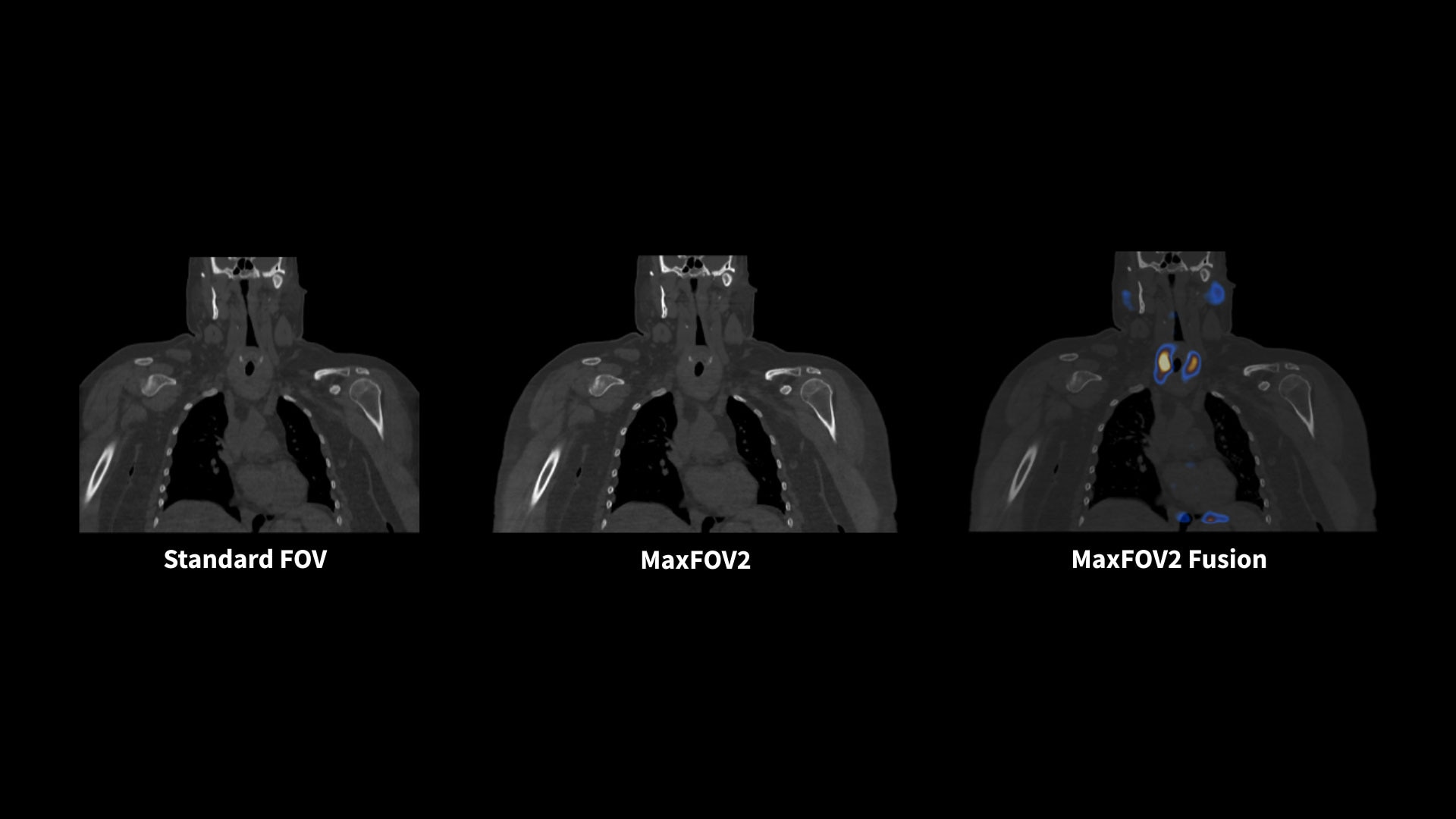 Product Media Carousel Image