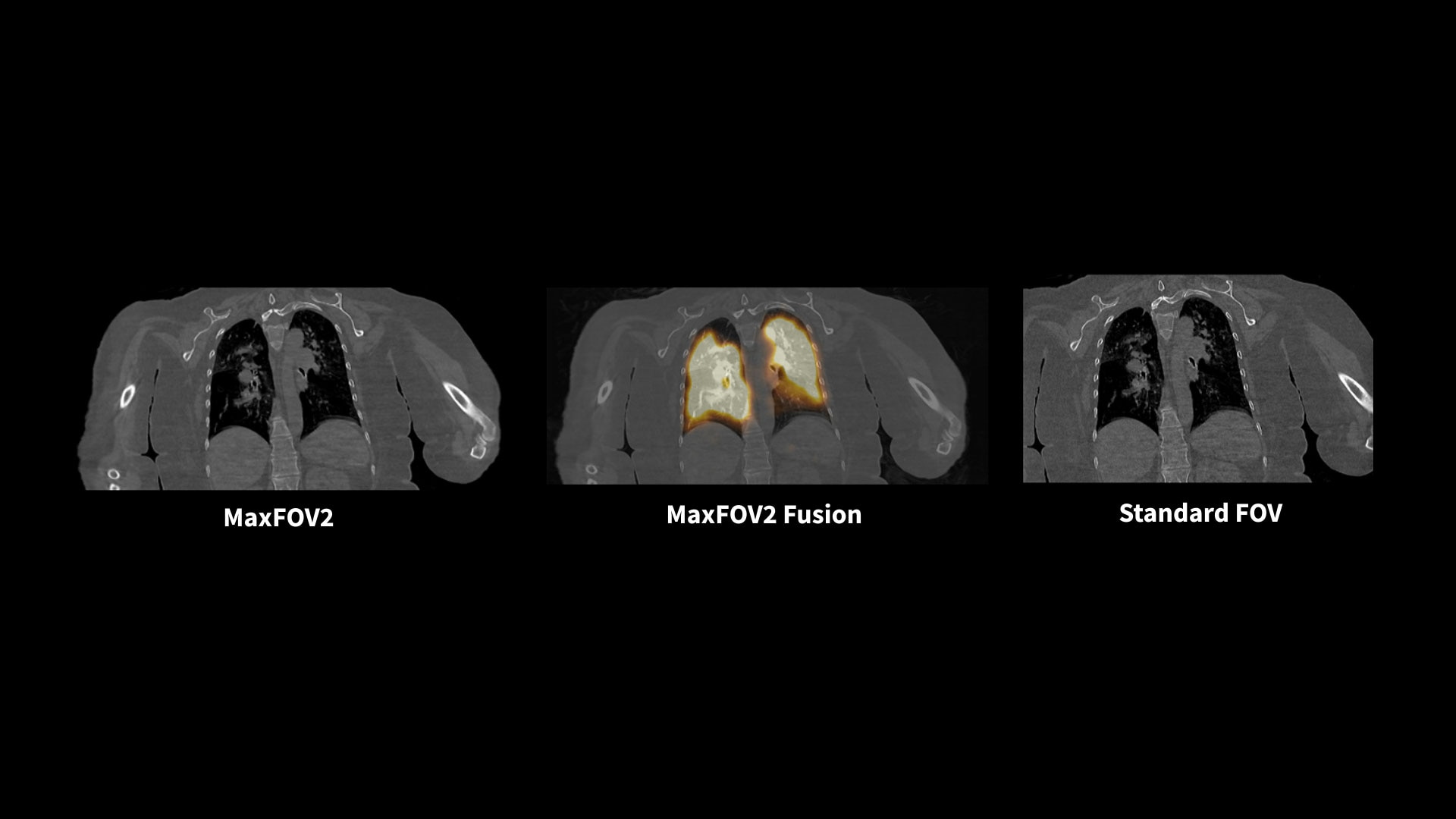 Product Media Carousel Image